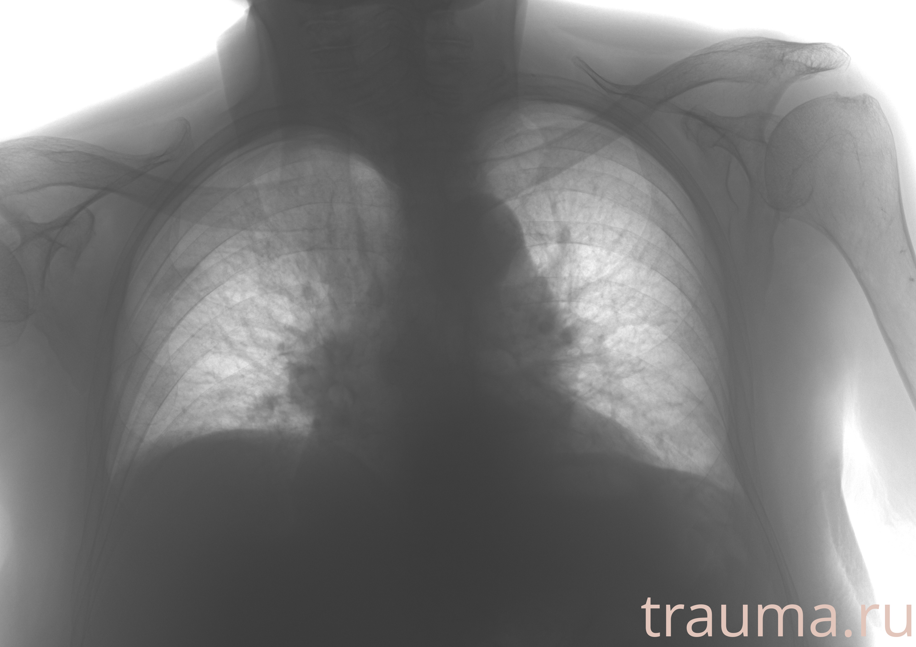 Рентген на дому: по вашему адресу приезжает врач-рентгенолог, травматолог-ортопед с мобильным рентгеновским аппаратом, проводит диагностику травмы или заболевания, делает необходимые рентгенограммы, дает рекомендации по дальнейшему лечению. Получить качественные снимки в домашних условиях возможно благодаря уникальной методике, разработанной МосРентген Центром для института  Склифосовского