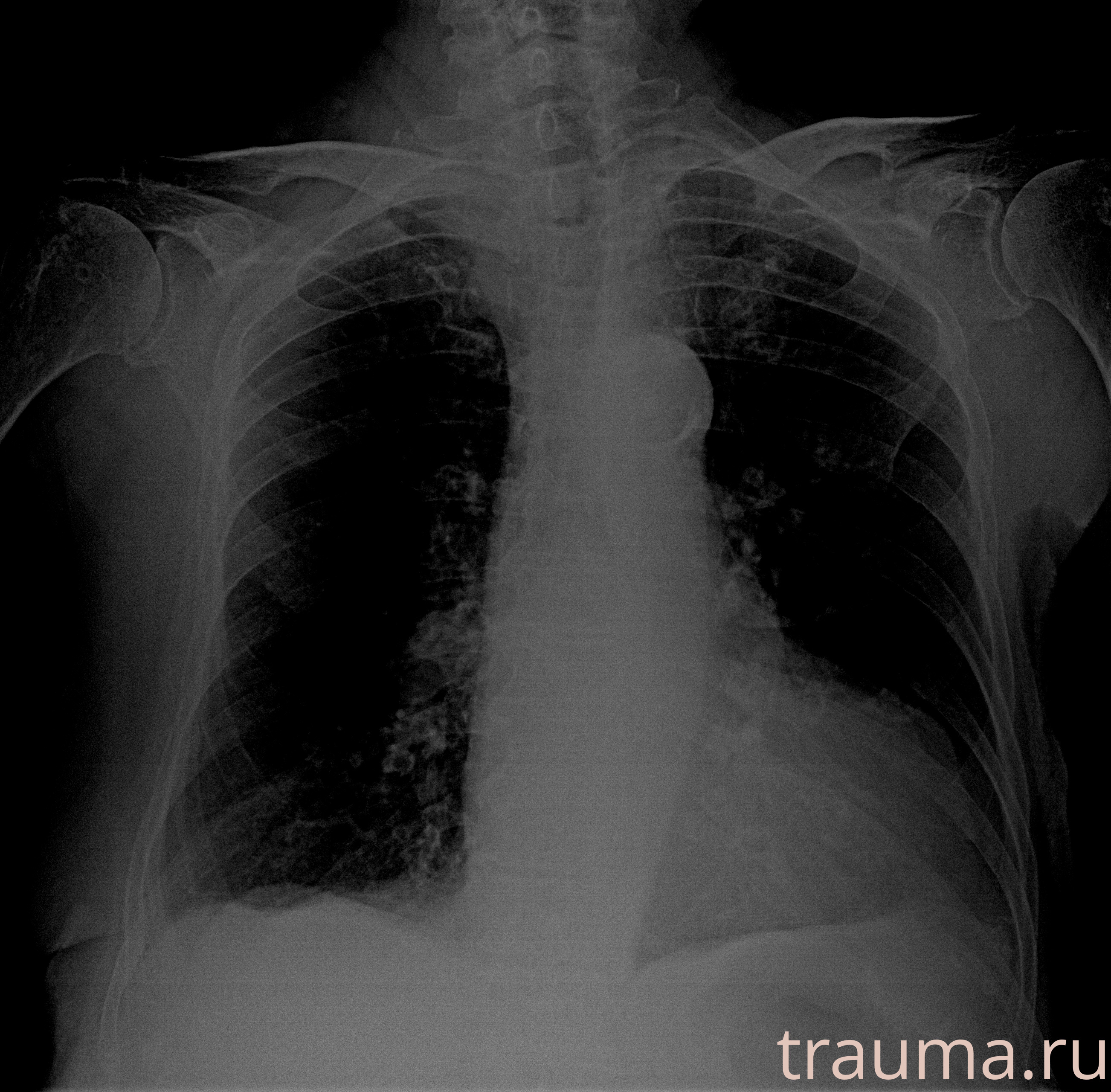 Рентген на дому: по вашему адресу приезжает врач-рентгенолог, травматолог-ортопед с мобильным рентгеновским аппаратом, проводит диагностику травмы или заболевания, делает необходимые рентгенограммы, дает рекомендации по дальнейшему лечению. Получить качественные снимки в домашних условиях возможно благодаря уникальной методике, разработанной МосРентген Центром для института  Склифосовского