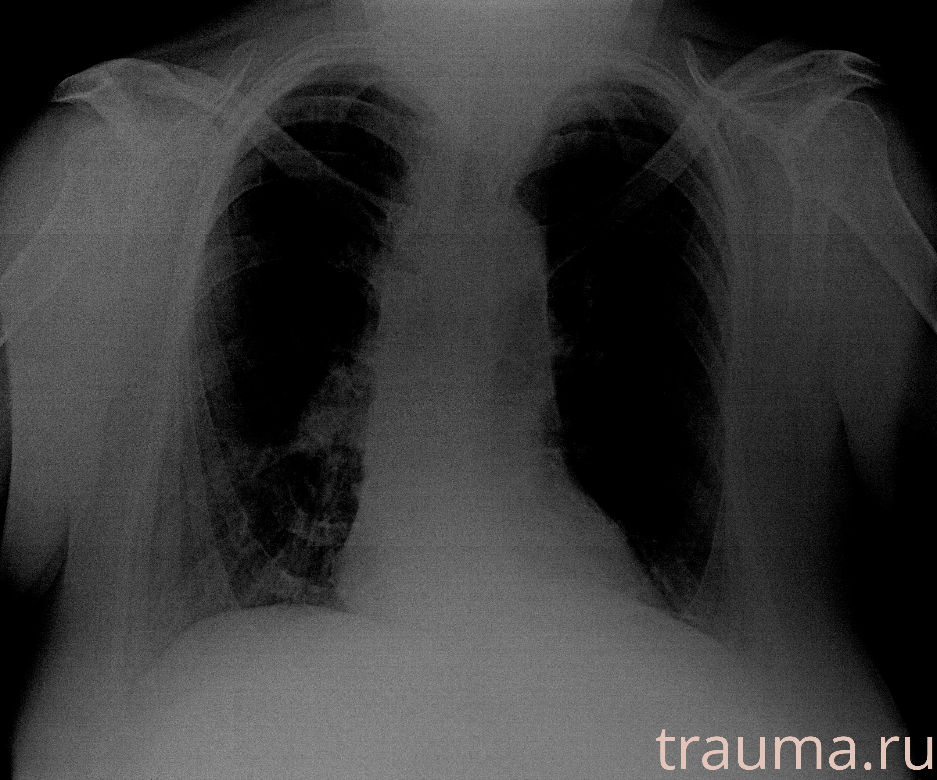 Рентген на дому: по вашему адресу приезжает врач-рентгенолог, травматолог-ортопед с мобильным рентгеновским аппаратом, проводит диагностику травмы или заболевания, делает необходимые рентгенограммы, дает рекомендации по дальнейшему лечению. Получить качественные снимки в домашних условиях возможно благодаря уникальной методике, разработанной МосРентген Центром для института  Склифосовского