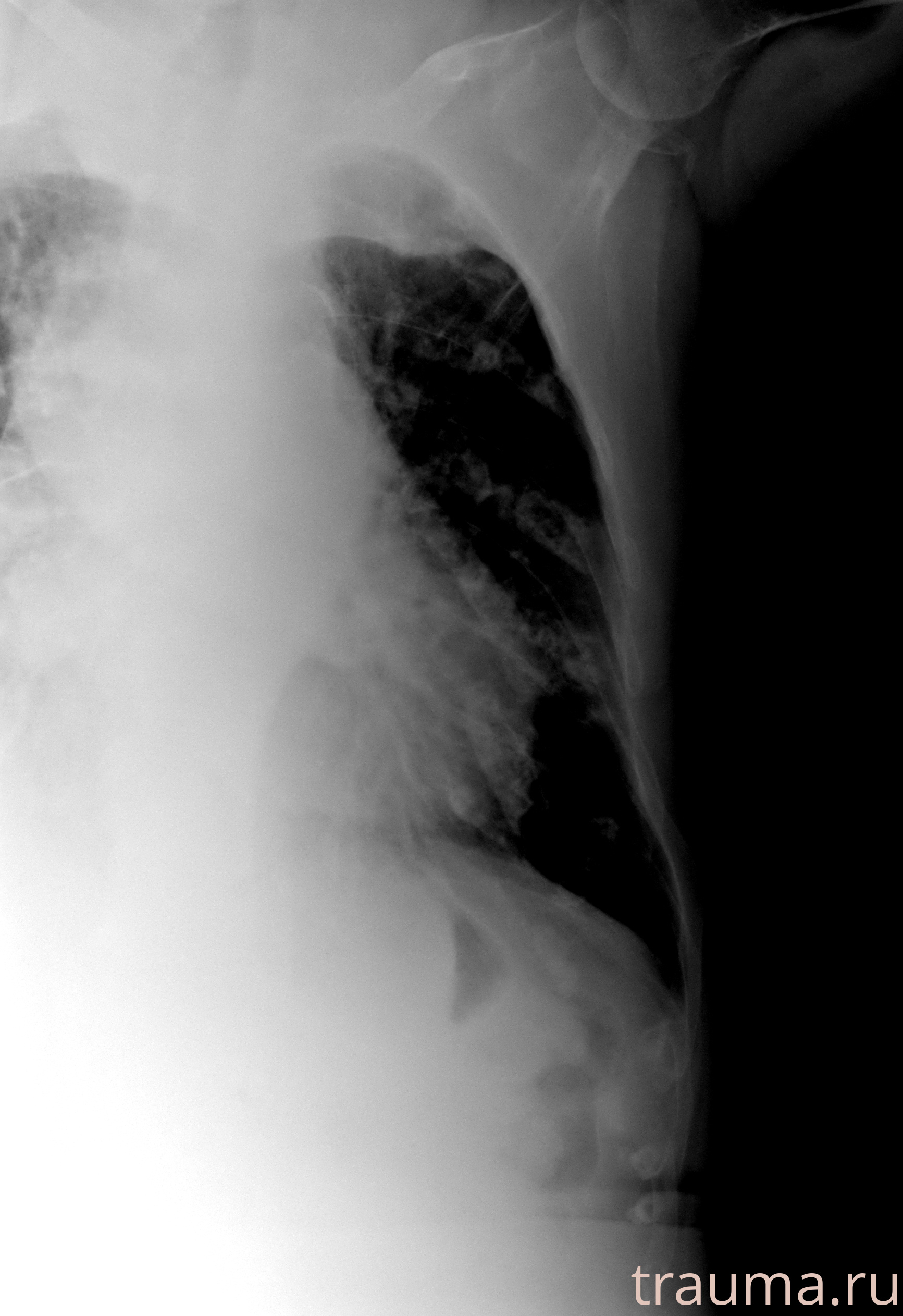 Рентген на дому: по вашему адресу приезжает врач-рентгенолог, травматолог-ортопед с мобильным рентгеновским аппаратом, проводит диагностику травмы или заболевания, делает необходимые рентгенограммы, дает рекомендации по дальнейшему лечению. Получить качественные снимки в домашних условиях возможно благодаря уникальной методике, разработанной МосРентген Центром для института  Склифосовского