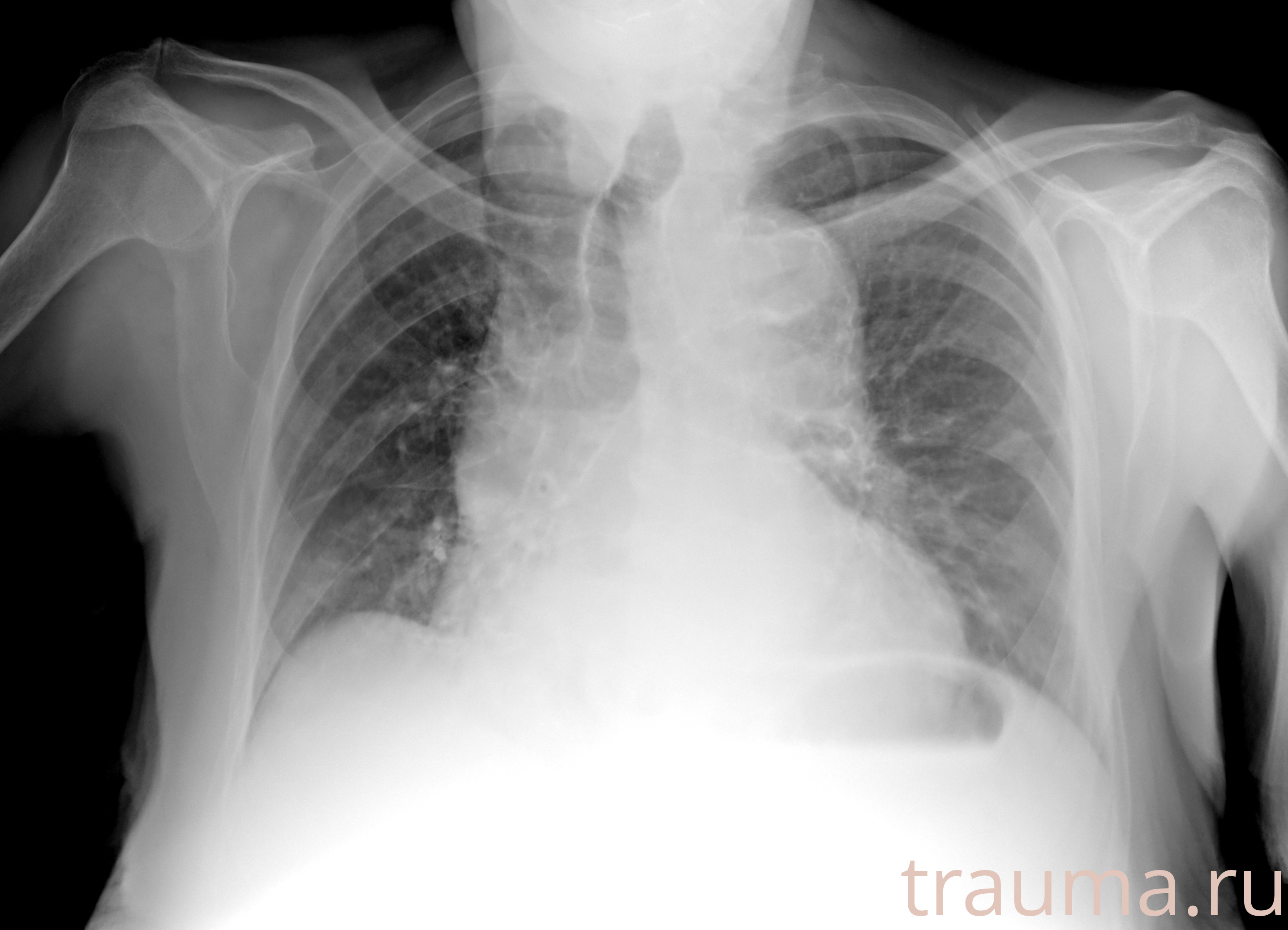 Рентген на дому: по вашему адресу приезжает врач-рентгенолог, травматолог-ортопед с мобильным рентгеновским аппаратом, проводит диагностику травмы или заболевания, делает необходимые рентгенограммы, дает рекомендации по дальнейшему лечению. Получить качественные снимки в домашних условиях возможно благодаря уникальной методике, разработанной МосРентген Центром для института  Склифосовского