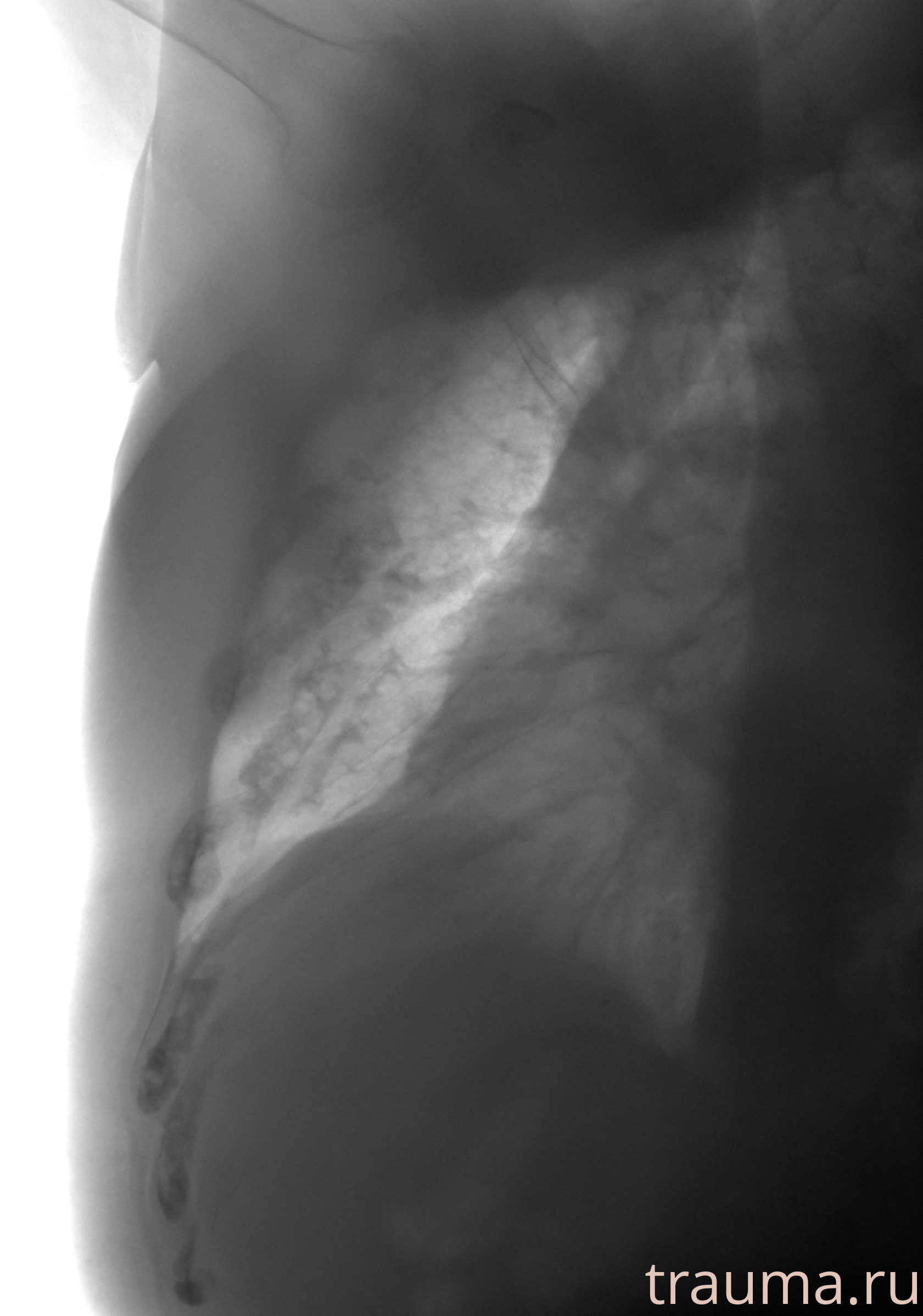 Рентген на дому: по вашему адресу приезжает врач-рентгенолог, травматолог-ортопед с мобильным рентгеновским аппаратом, проводит диагностику травмы или заболевания, делает необходимые рентгенограммы, дает рекомендации по дальнейшему лечению. Получить качественные снимки в домашних условиях возможно благодаря уникальной методике, разработанной МосРентген Центром для института  Склифосовского