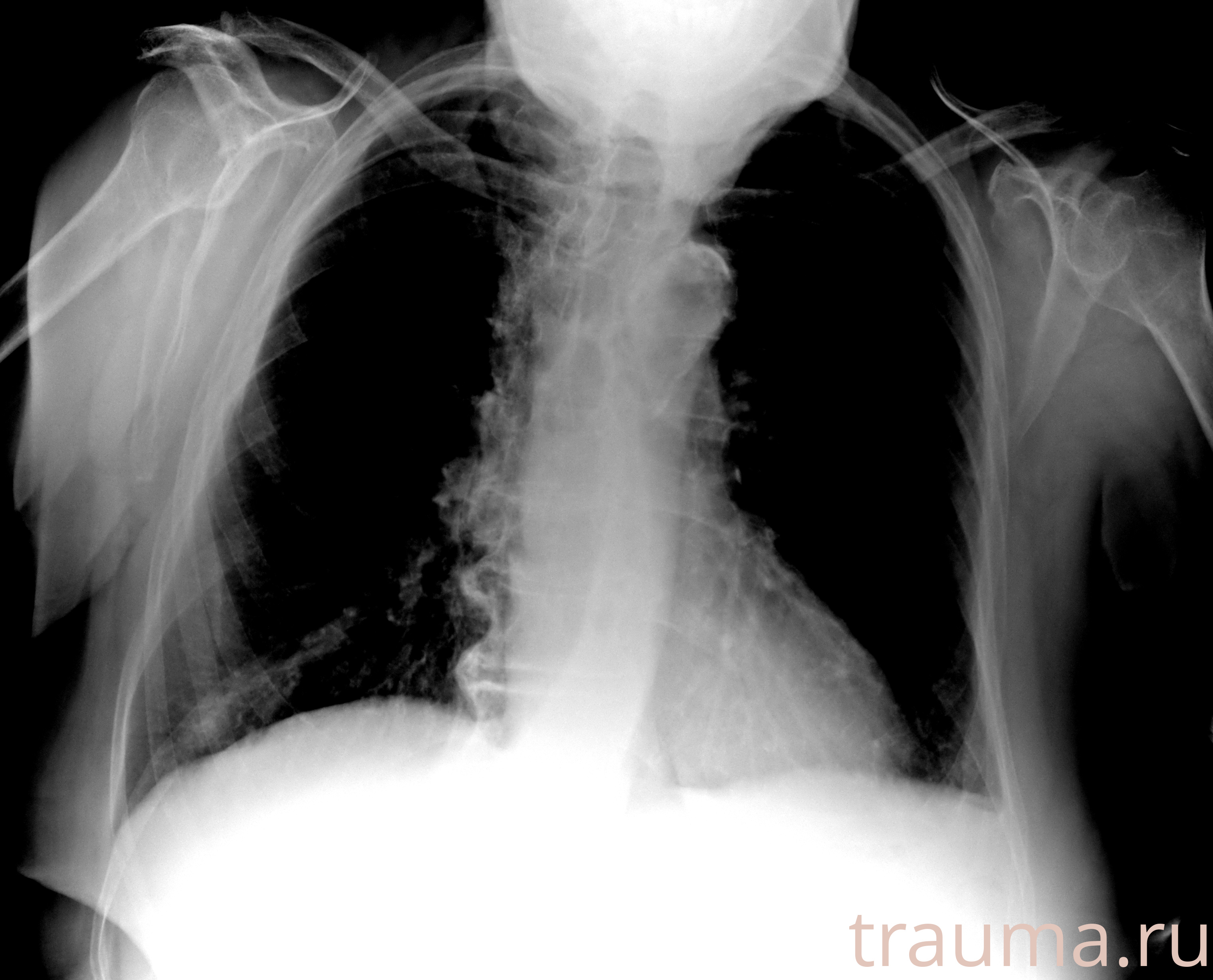 Рентген на дому: по вашему адресу приезжает врач-рентгенолог, травматолог-ортопед с мобильным рентгеновским аппаратом, проводит диагностику травмы или заболевания, делает необходимые рентгенограммы, дает рекомендации по дальнейшему лечению. Получить качественные снимки в домашних условиях возможно благодаря уникальной методике, разработанной МосРентген Центром для института  Склифосовского