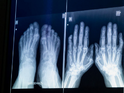 Детская больница Челябинска получила новый цифровой рентген-аппарат