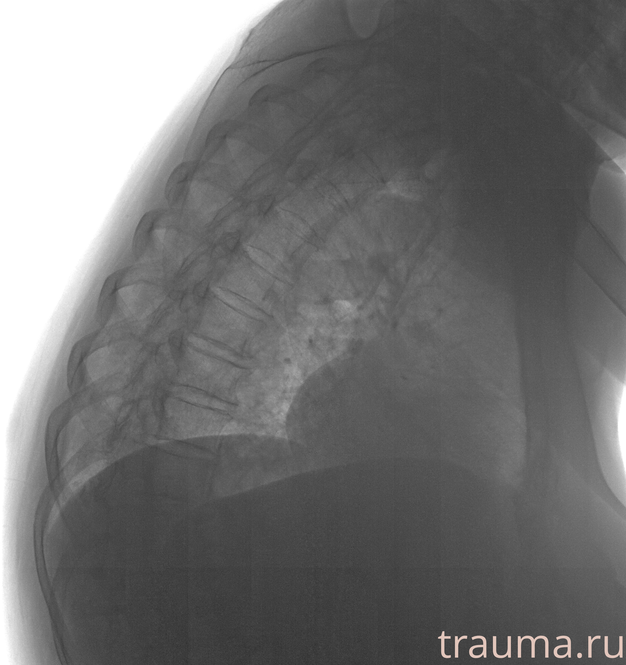 Рентген на дому: по вашему адресу приезжает врач-рентгенолог, травматолог-ортопед с мобильным рентгеновским аппаратом, проводит диагностику травмы или заболевания, делает необходимые рентгенограммы, дает рекомендации по дальнейшему лечению. Получить качественные снимки в домашних условиях возможно благодаря уникальной методике, разработанной МосРентген Центром для института  Склифосовского