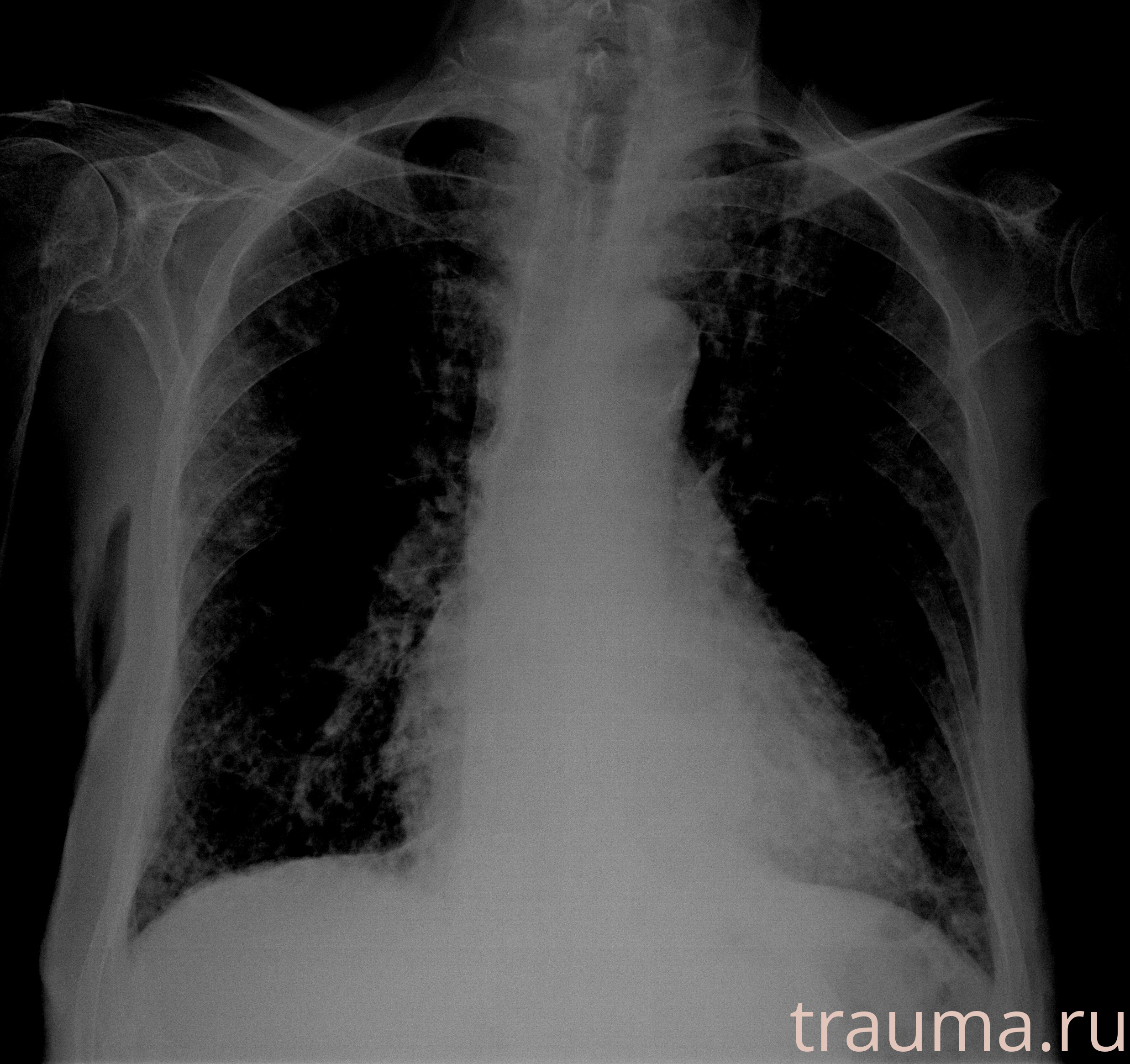 Рентген на дому: по вашему адресу приезжает врач-рентгенолог, травматолог-ортопед с мобильным рентгеновским аппаратом, проводит диагностику травмы или заболевания, делает необходимые рентгенограммы, дает рекомендации по дальнейшему лечению. Получить качественные снимки в домашних условиях возможно благодаря уникальной методике, разработанной МосРентген Центром для института  Склифосовского