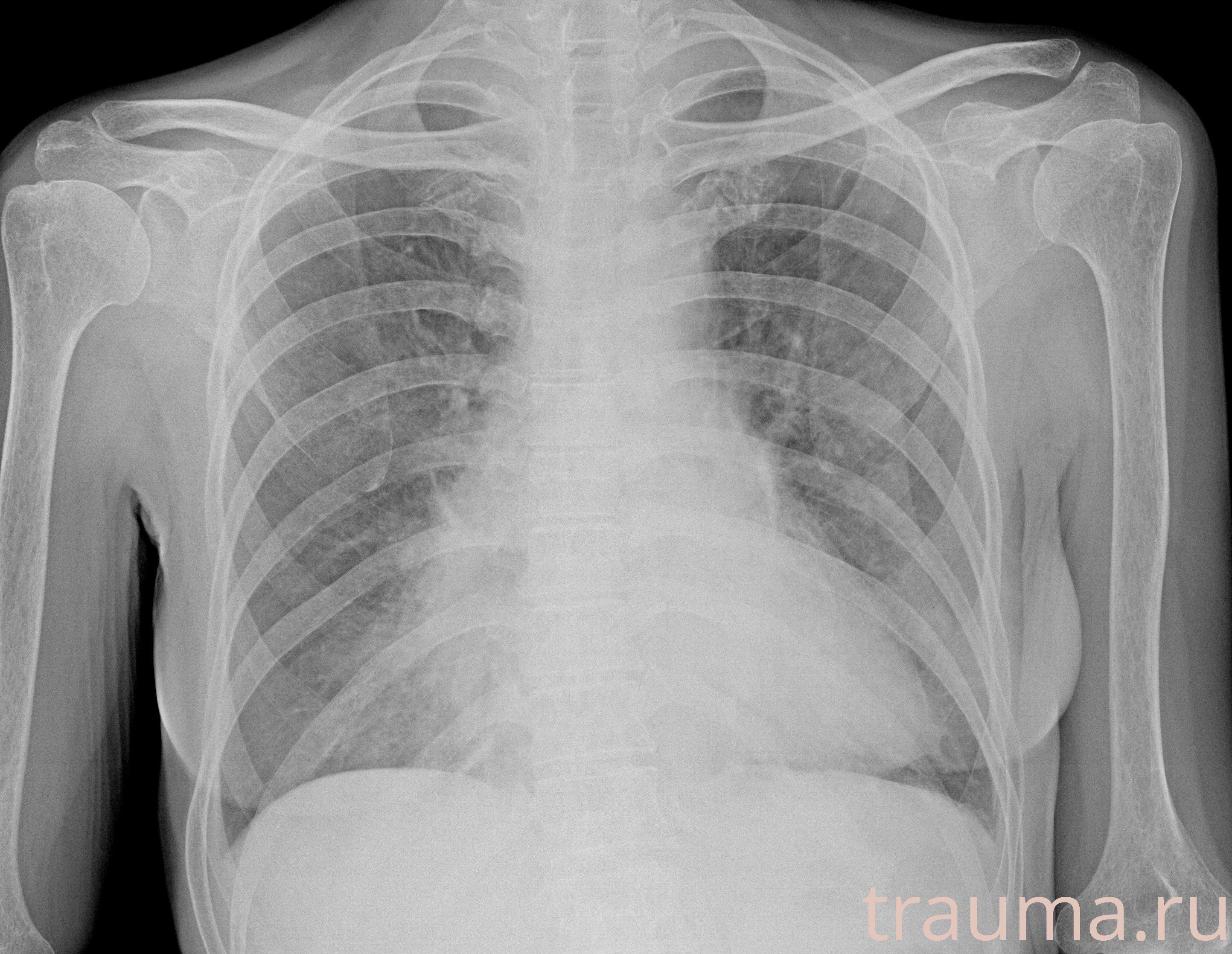 Рентген на дому: по вашему адресу приезжает врач-рентгенолог, травматолог-ортопед с мобильным рентгеновским аппаратом, проводит диагностику травмы или заболевания, делает необходимые рентгенограммы, дает рекомендации по дальнейшему лечению. Получить качественные снимки в домашних условиях возможно благодаря уникальной методике, разработанной МосРентген Центром для института  Склифосовского