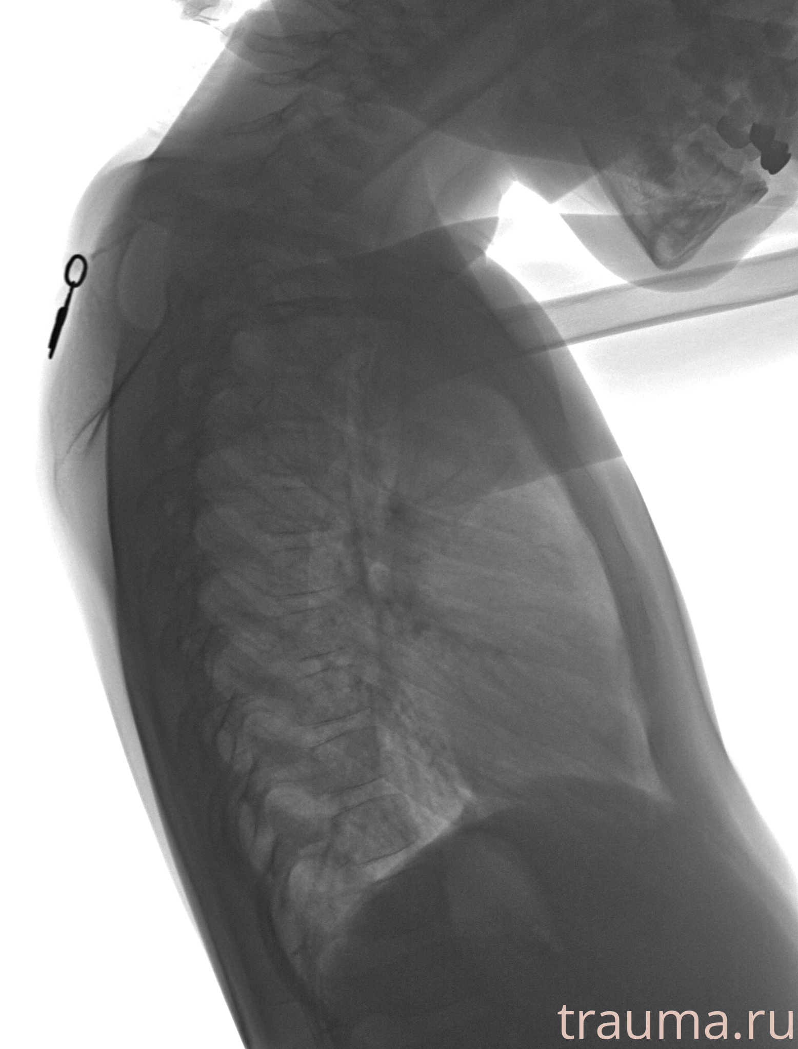 Рентген на дому: по вашему адресу приезжает врач-рентгенолог, травматолог-ортопед с мобильным рентгеновским аппаратом, проводит диагностику травмы или заболевания, делает необходимые рентгенограммы, дает рекомендации по дальнейшему лечению. Получить качественные снимки в домашних условиях возможно благодаря уникальной методике, разработанной МосРентген Центром для института  Склифосовского