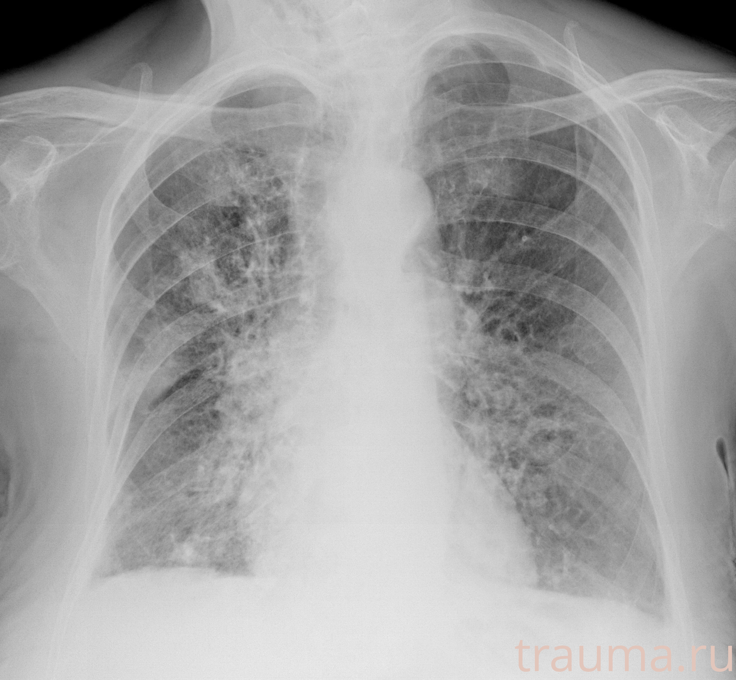 Рентген на дому: по вашему адресу приезжает врач-рентгенолог, травматолог-ортопед с мобильным рентгеновским аппаратом, проводит диагностику травмы или заболевания, делает необходимые рентгенограммы, дает рекомендации по дальнейшему лечению. Получить качественные снимки в домашних условиях возможно благодаря уникальной методике, разработанной МосРентген Центром для института  Склифосовского