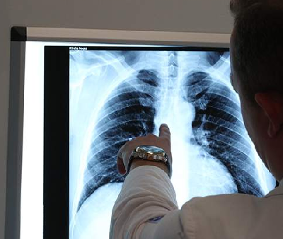 Врач развеяла мифы о рентгене