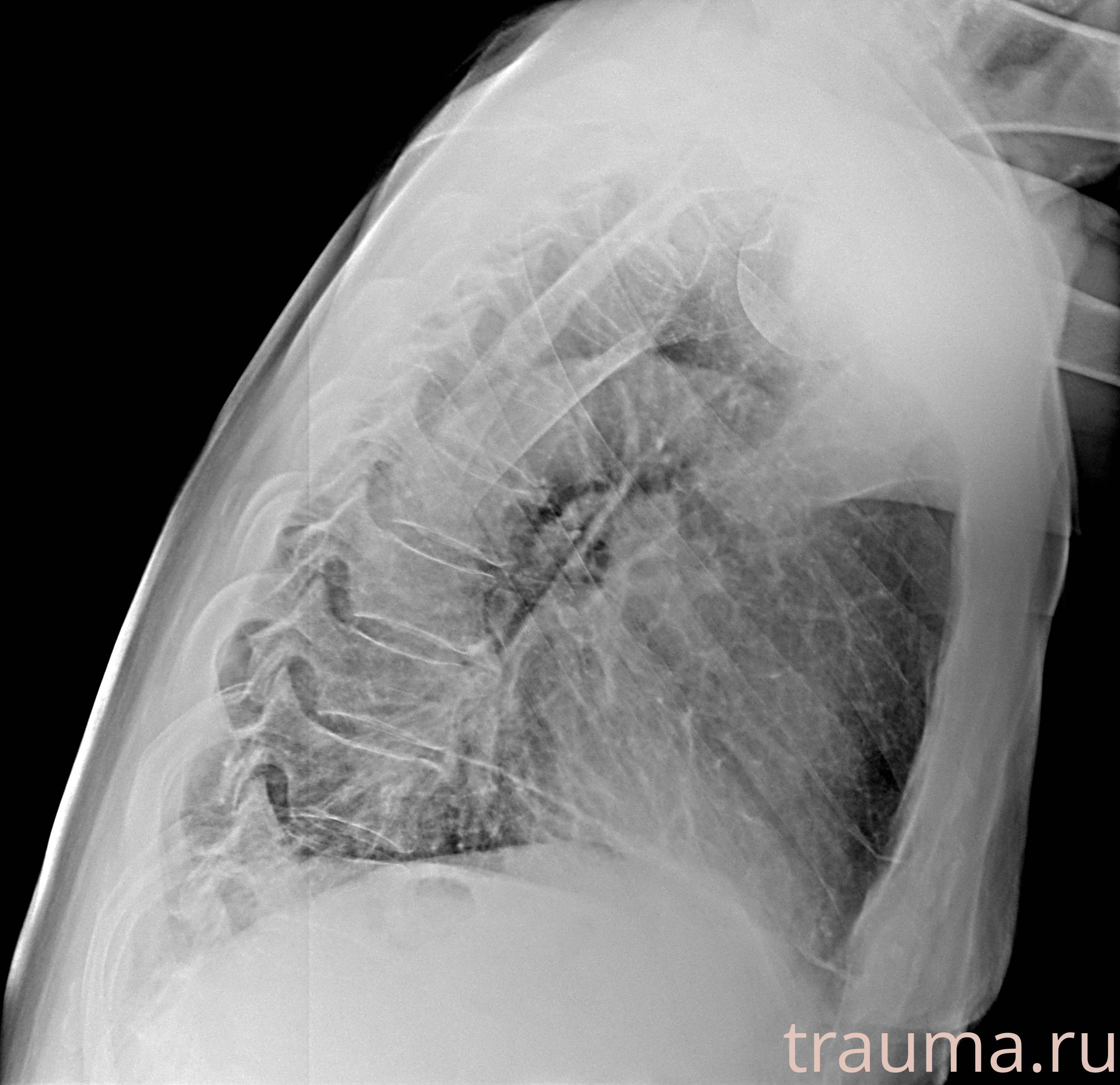 Рентген на дому: по вашему адресу приезжает врач-рентгенолог, травматолог-ортопед с мобильным рентгеновским аппаратом, проводит диагностику травмы или заболевания, делает необходимые рентгенограммы, дает рекомендации по дальнейшему лечению. Получить качественные снимки в домашних условиях возможно благодаря уникальной методике, разработанной МосРентген Центром для института  Склифосовского