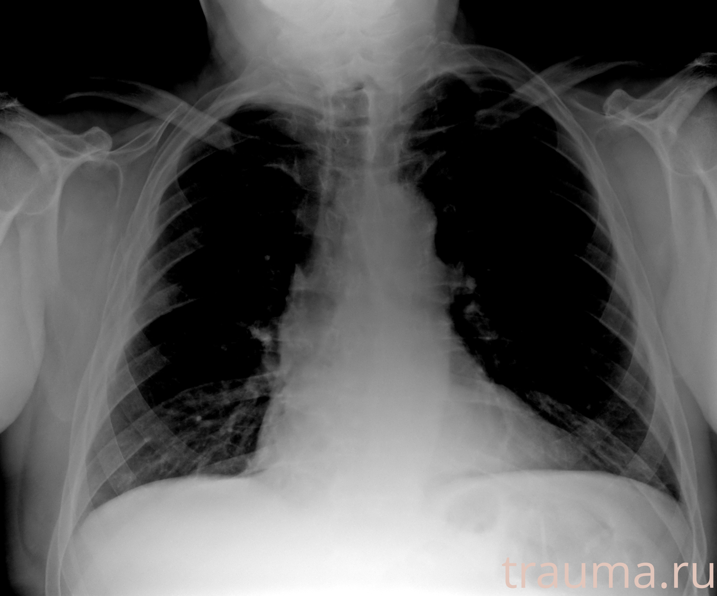 Рентген на дому: по вашему адресу приезжает врач-рентгенолог, травматолог-ортопед с мобильным рентгеновским аппаратом, проводит диагностику травмы или заболевания, делает необходимые рентгенограммы, дает рекомендации по дальнейшему лечению. Получить качественные снимки в домашних условиях возможно благодаря уникальной методике, разработанной МосРентген Центром для института  Склифосовского