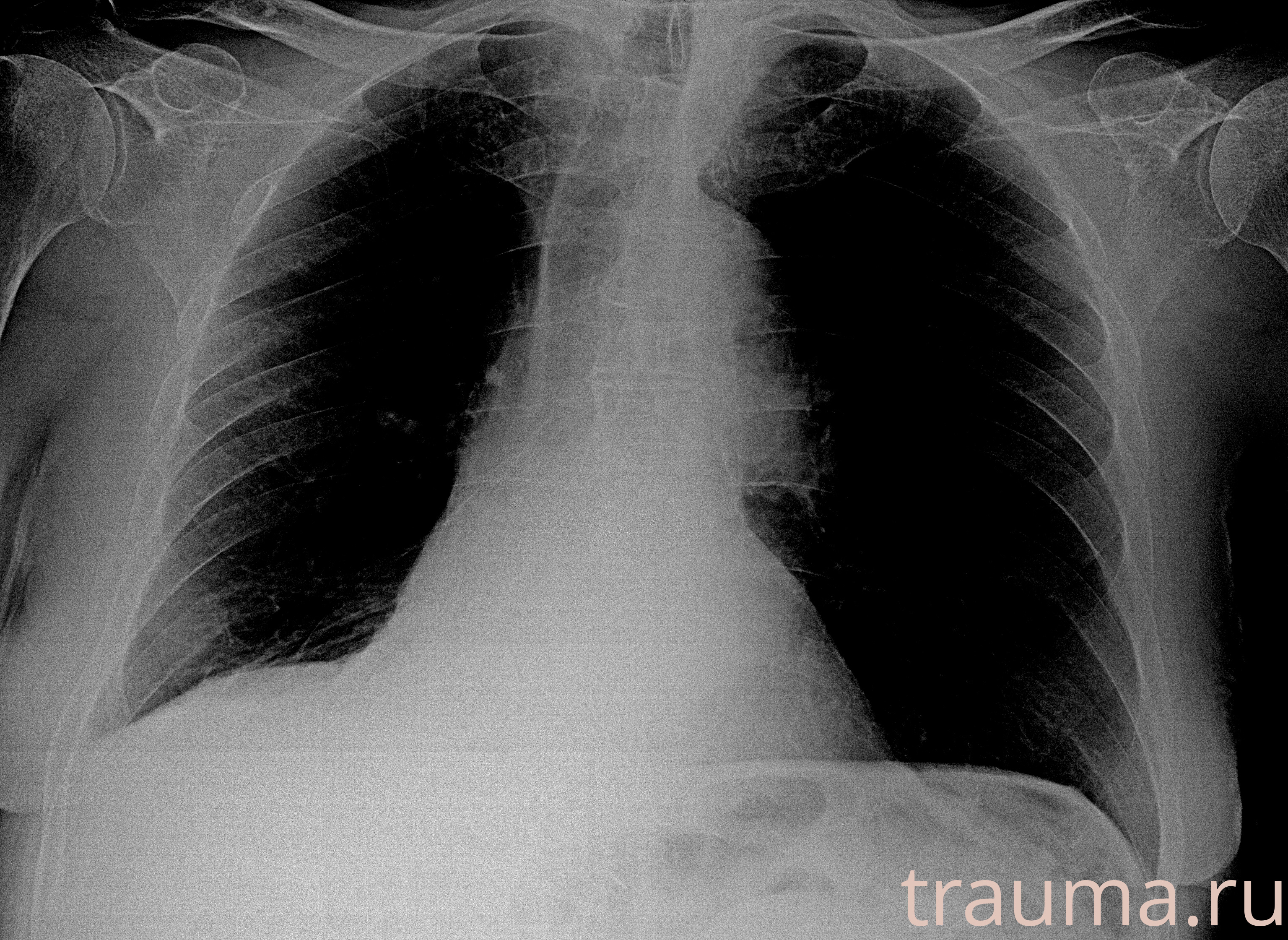 Рентген на дому: по вашему адресу приезжает врач-рентгенолог, травматолог-ортопед с мобильным рентгеновским аппаратом, проводит диагностику травмы или заболевания, делает необходимые рентгенограммы, дает рекомендации по дальнейшему лечению. Получить качественные снимки в домашних условиях возможно благодаря уникальной методике, разработанной МосРентген Центром для института  Склифосовского