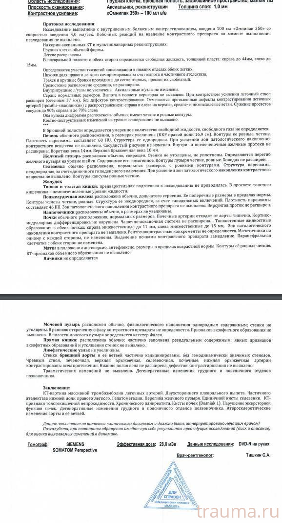 Рентген на дому: по вашему адресу приезжает врач-рентгенолог, травматолог-ортопед с мобильным рентгеновским аппаратом, проводит диагностику травмы или заболевания, делает необходимые рентгенограммы, дает рекомендации по дальнейшему лечению. Получить качественные снимки в домашних условиях возможно благодаря уникальной методике, разработанной МосРентген Центром для института  Склифосовского