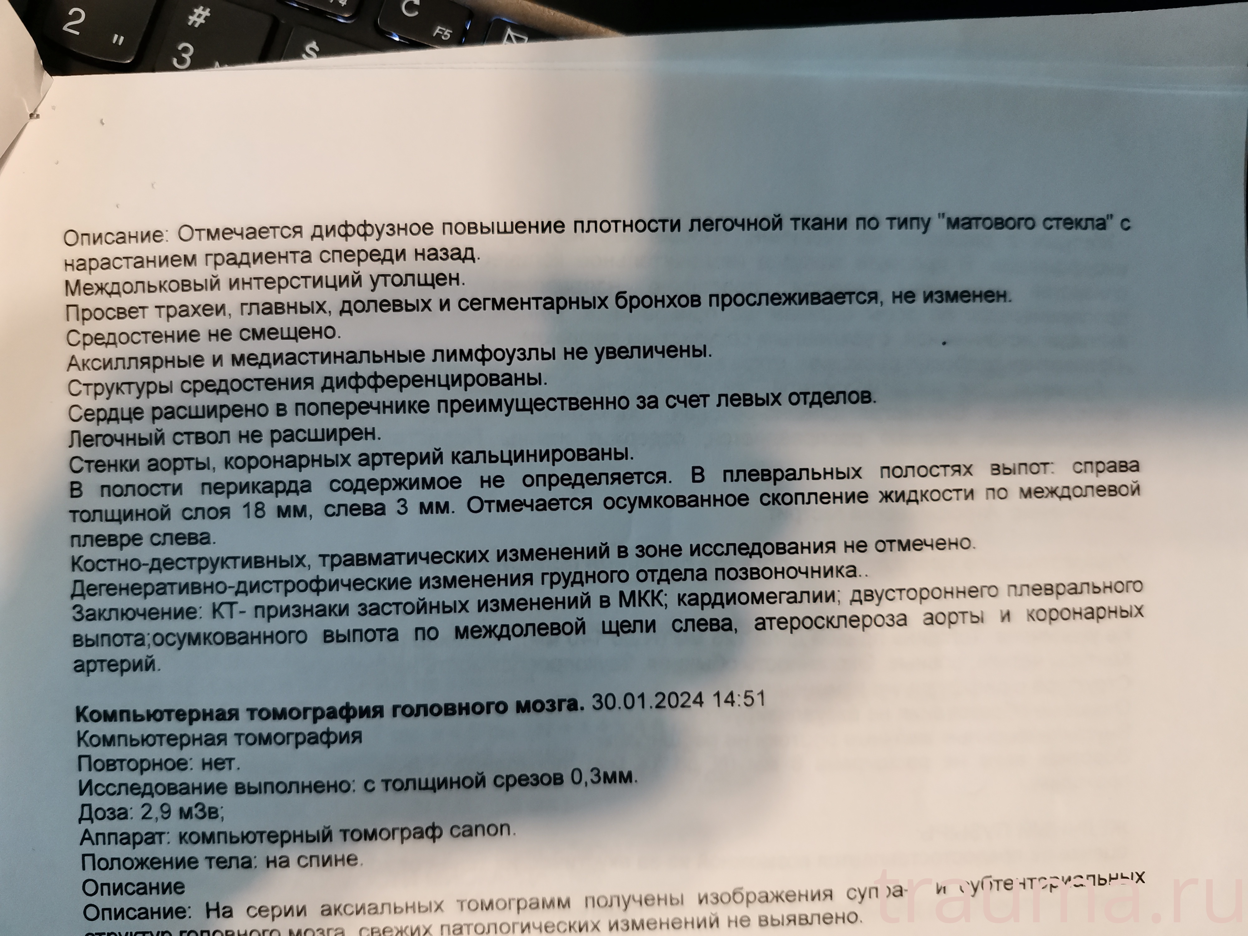 Рентген на дому: по вашему адресу приезжает врач-рентгенолог, травматолог-ортопед с мобильным рентгеновским аппаратом, проводит диагностику травмы или заболевания, делает необходимые рентгенограммы, дает рекомендации по дальнейшему лечению. Получить качественные снимки в домашних условиях возможно благодаря уникальной методике, разработанной МосРентген Центром для института  Склифосовского