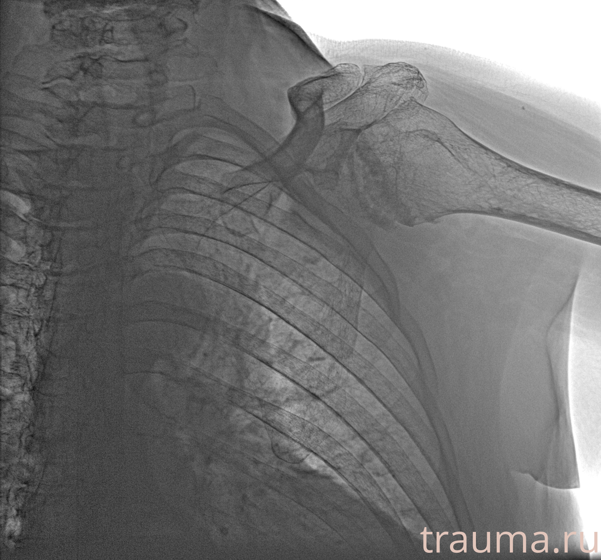 Рентген на дому: по вашему адресу приезжает врач-рентгенолог, травматолог-ортопед с мобильным рентгеновским аппаратом, проводит диагностику травмы или заболевания, делает необходимые рентгенограммы, дает рекомендации по дальнейшему лечению. Получить качественные снимки в домашних условиях возможно благодаря уникальной методике, разработанной МосРентген Центром для института  Склифосовского