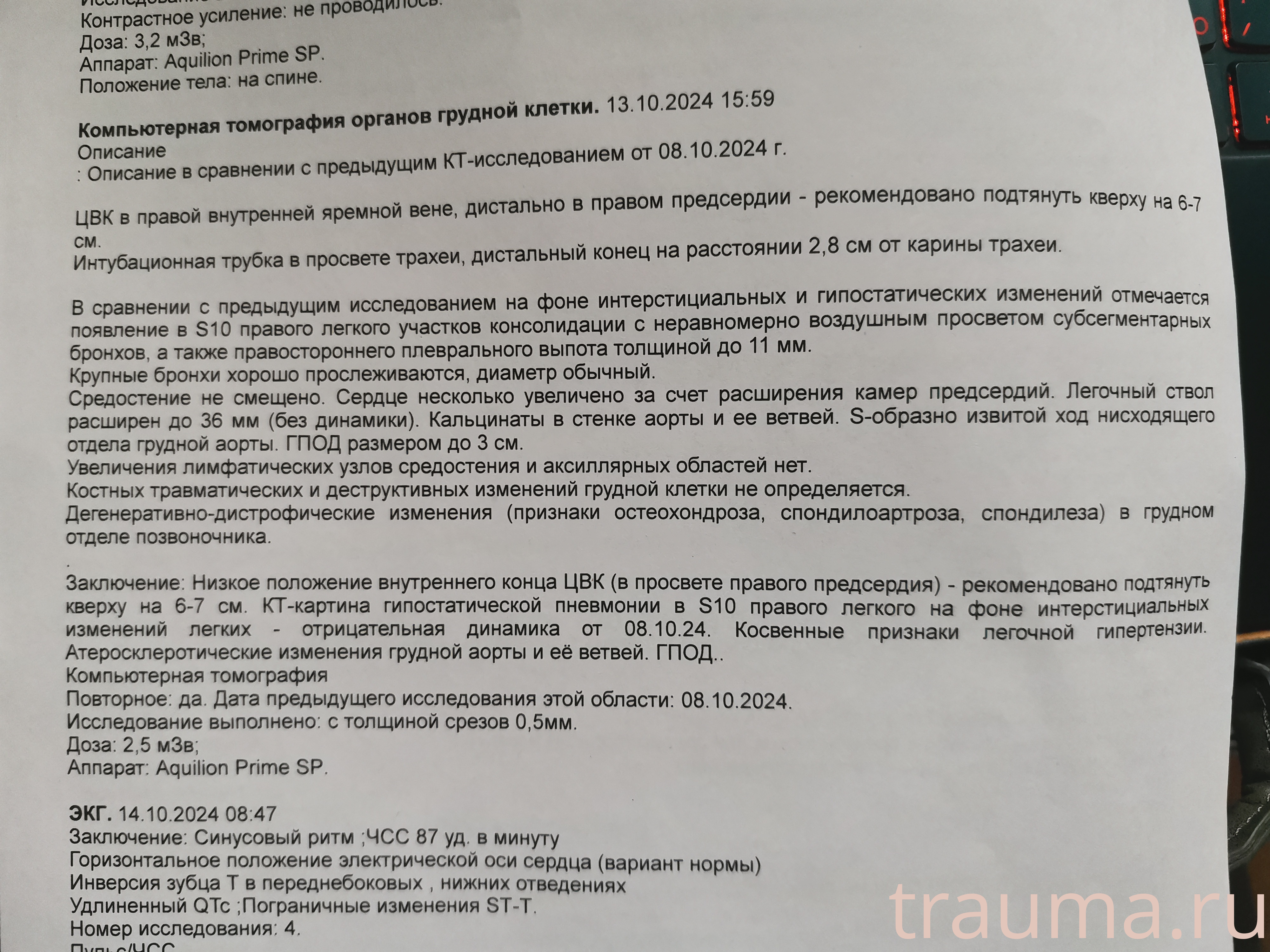 Рентген на дому: по вашему адресу приезжает врач-рентгенолог, травматолог-ортопед с мобильным рентгеновским аппаратом, проводит диагностику травмы или заболевания, делает необходимые рентгенограммы, дает рекомендации по дальнейшему лечению. Получить качественные снимки в домашних условиях возможно благодаря уникальной методике, разработанной МосРентген Центром для института  Склифосовского