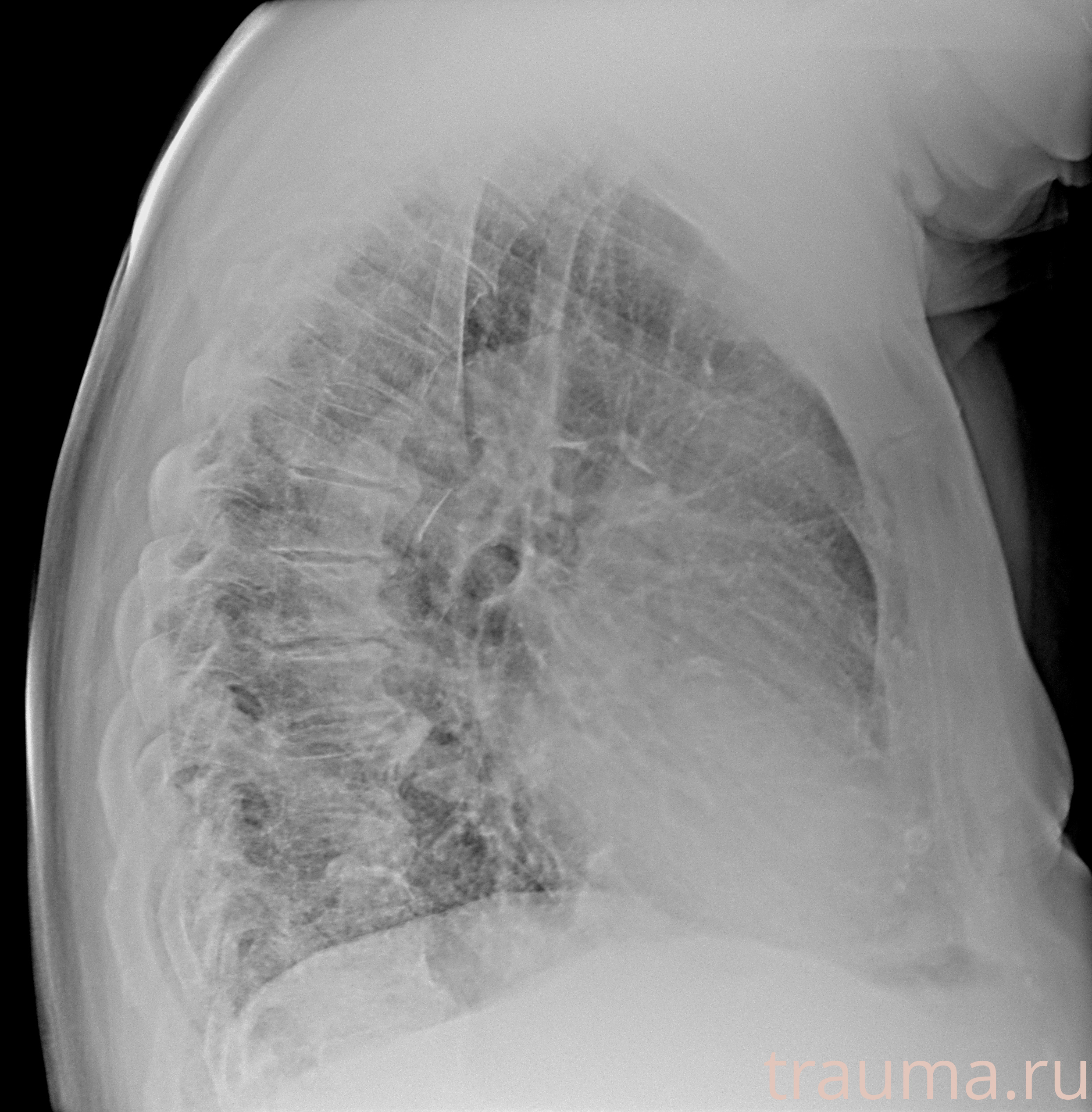 Рентген на дому: по вашему адресу приезжает врач-рентгенолог, травматолог-ортопед с мобильным рентгеновским аппаратом, проводит диагностику травмы или заболевания, делает необходимые рентгенограммы, дает рекомендации по дальнейшему лечению. Получить качественные снимки в домашних условиях возможно благодаря уникальной методике, разработанной МосРентген Центром для института  Склифосовского