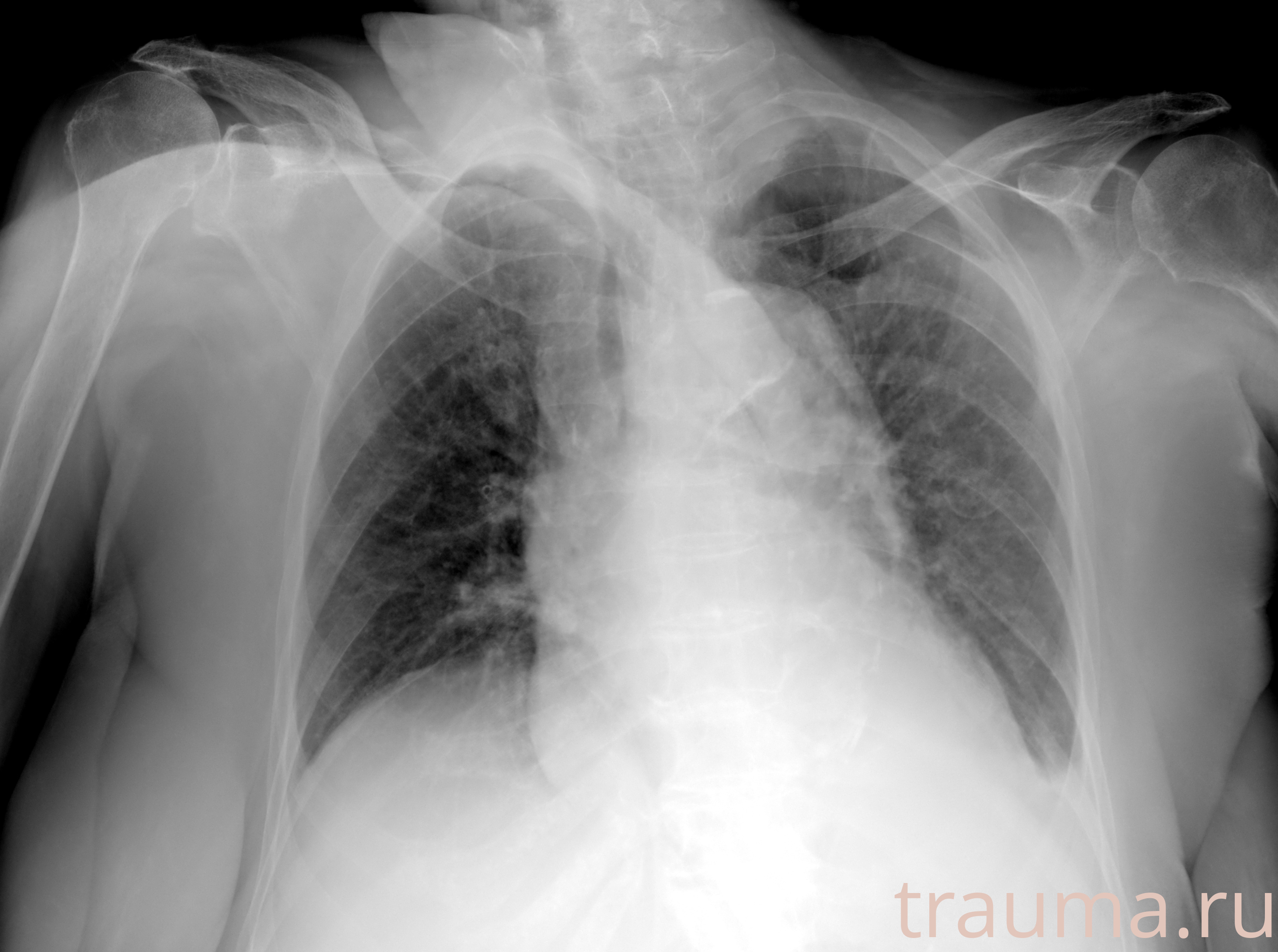 Рентген на дому: по вашему адресу приезжает врач-рентгенолог, травматолог-ортопед с мобильным рентгеновским аппаратом, проводит диагностику травмы или заболевания, делает необходимые рентгенограммы, дает рекомендации по дальнейшему лечению. Получить качественные снимки в домашних условиях возможно благодаря уникальной методике, разработанной МосРентген Центром для института  Склифосовского