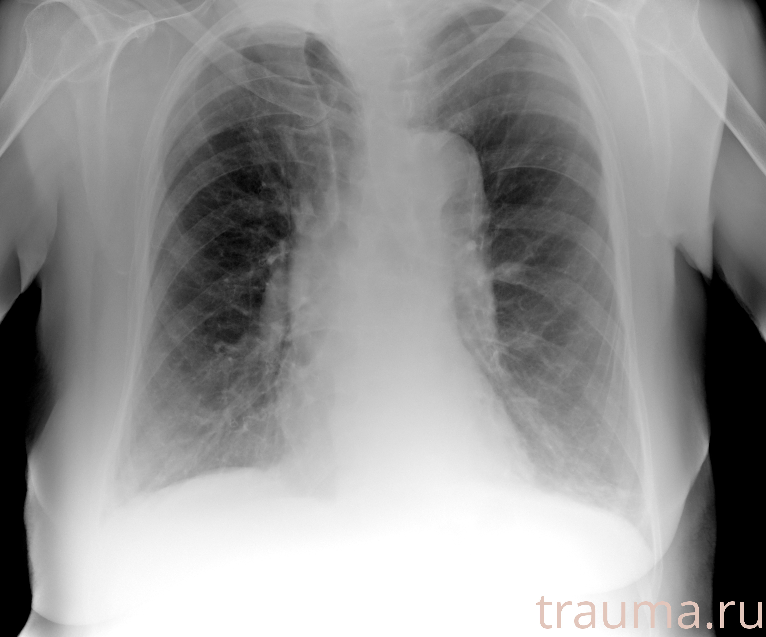 Рентген на дому: по вашему адресу приезжает врач-рентгенолог, травматолог-ортопед с мобильным рентгеновским аппаратом, проводит диагностику травмы или заболевания, делает необходимые рентгенограммы, дает рекомендации по дальнейшему лечению. Получить качественные снимки в домашних условиях возможно благодаря уникальной методике, разработанной МосРентген Центром для института  Склифосовского