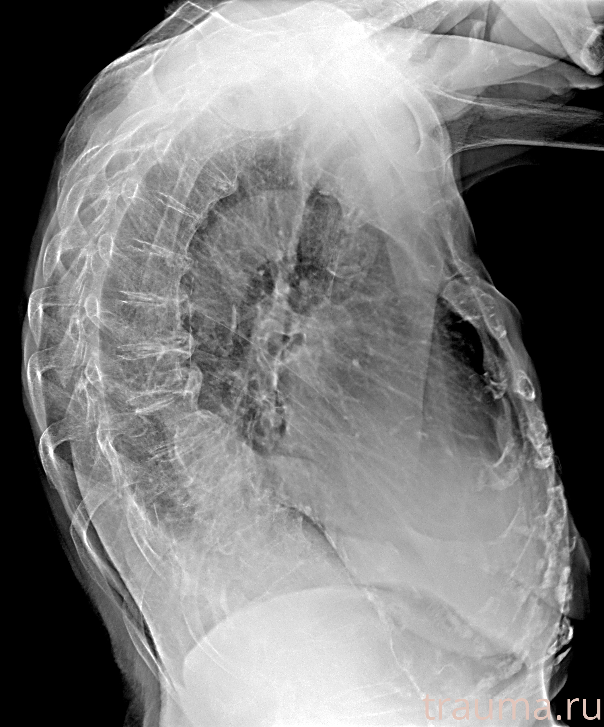 Рентген на дому: по вашему адресу приезжает врач-рентгенолог, травматолог-ортопед с мобильным рентгеновским аппаратом, проводит диагностику травмы или заболевания, делает необходимые рентгенограммы, дает рекомендации по дальнейшему лечению. Получить качественные снимки в домашних условиях возможно благодаря уникальной методике, разработанной МосРентген Центром для института  Склифосовского