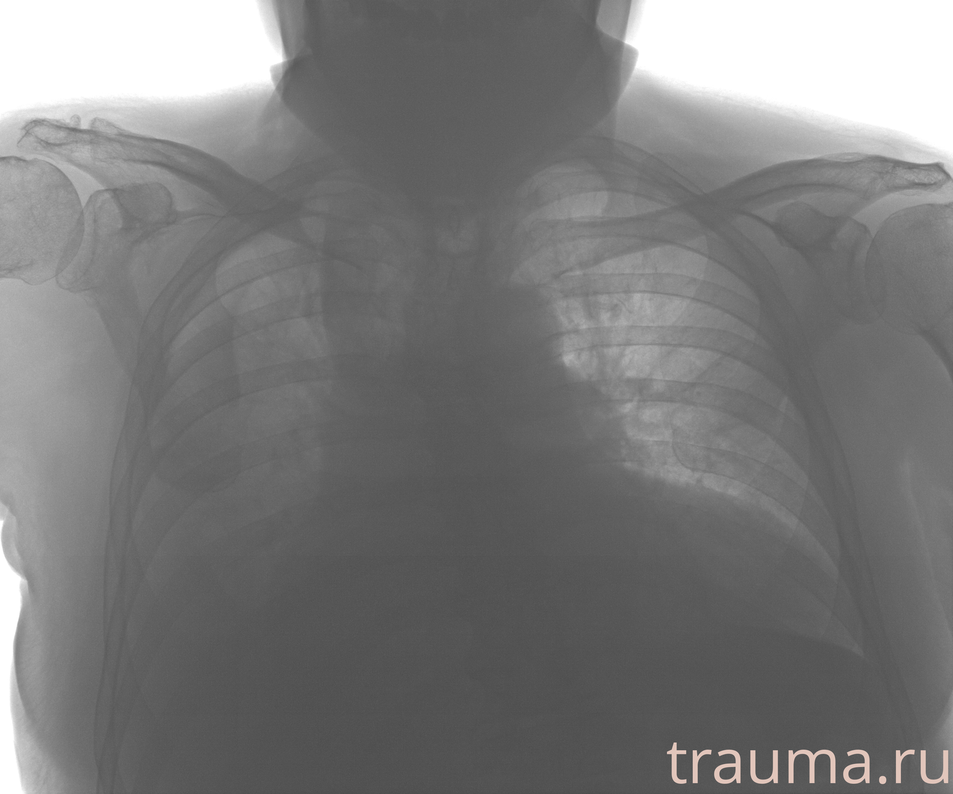 Рентген на дому: по вашему адресу приезжает врач-рентгенолог, травматолог-ортопед с мобильным рентгеновским аппаратом, проводит диагностику травмы или заболевания, делает необходимые рентгенограммы, дает рекомендации по дальнейшему лечению. Получить качественные снимки в домашних условиях возможно благодаря уникальной методике, разработанной МосРентген Центром для института  Склифосовского