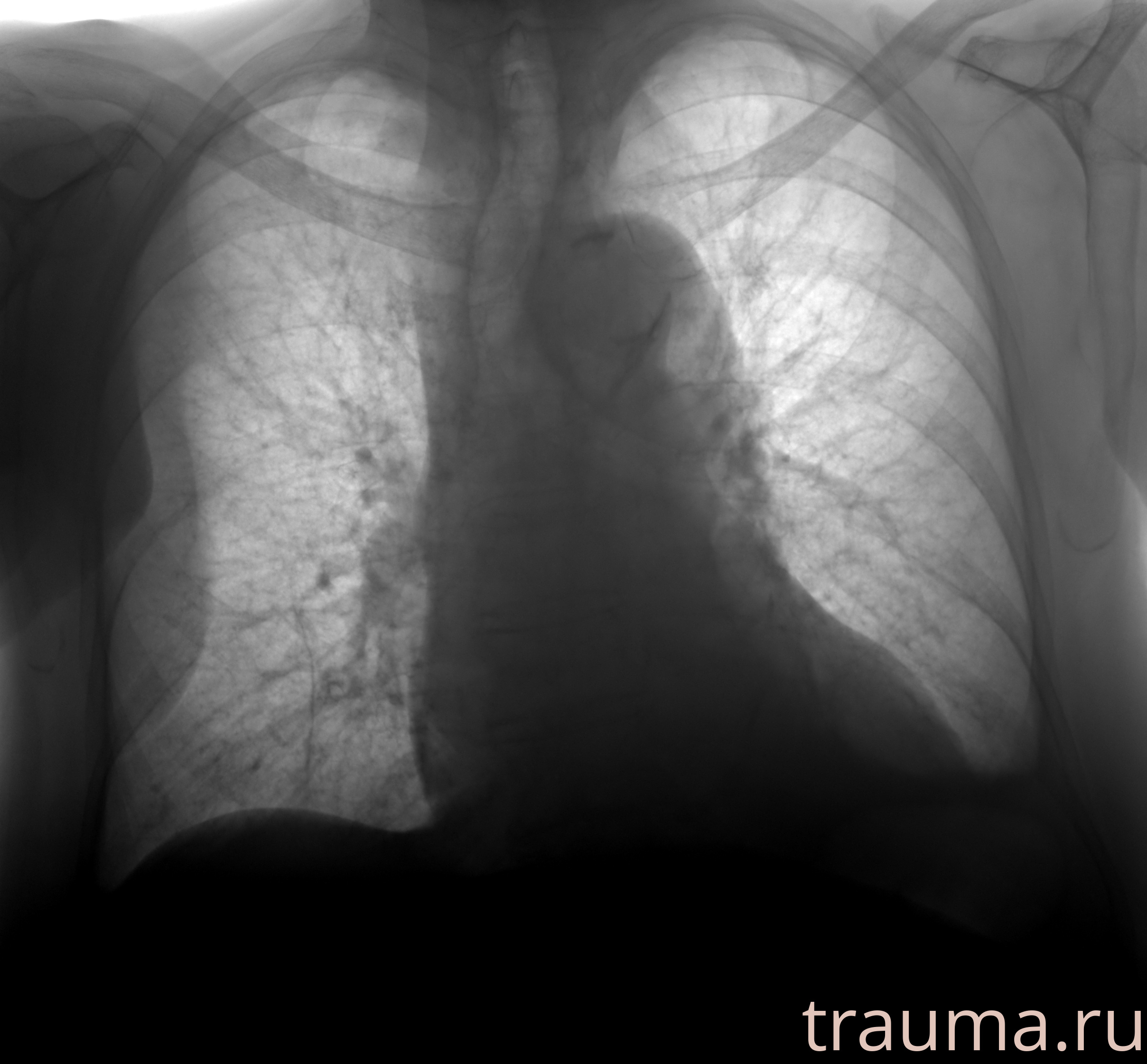 Рентген на дому: по вашему адресу приезжает врач-рентгенолог, травматолог-ортопед с мобильным рентгеновским аппаратом, проводит диагностику травмы или заболевания, делает необходимые рентгенограммы, дает рекомендации по дальнейшему лечению. Получить качественные снимки в домашних условиях возможно благодаря уникальной методике, разработанной МосРентген Центром для института  Склифосовского