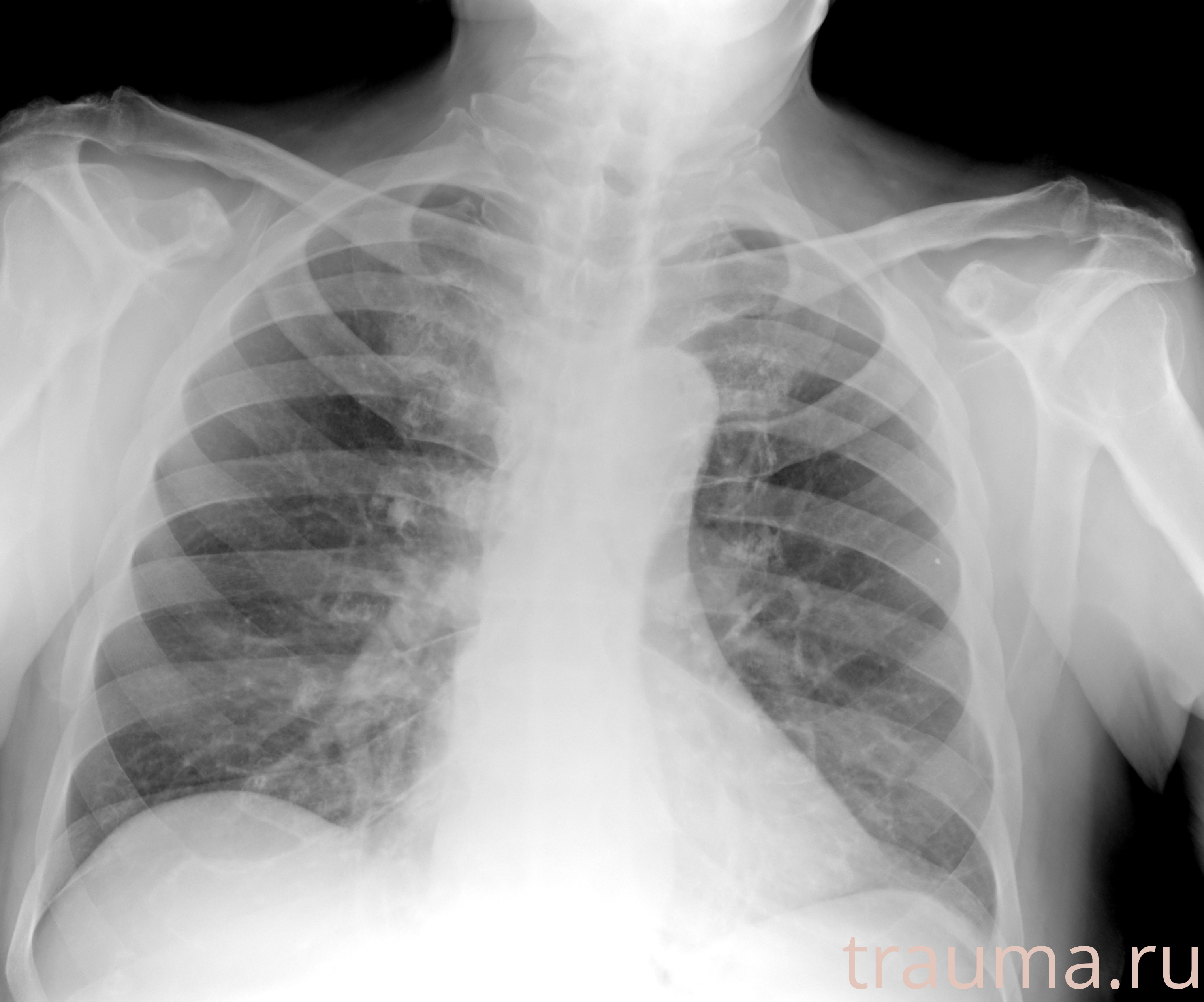 Рентген на дому: по вашему адресу приезжает врач-рентгенолог, травматолог-ортопед с мобильным рентгеновским аппаратом, проводит диагностику травмы или заболевания, делает необходимые рентгенограммы, дает рекомендации по дальнейшему лечению. Получить качественные снимки в домашних условиях возможно благодаря уникальной методике, разработанной МосРентген Центром для института  Склифосовского