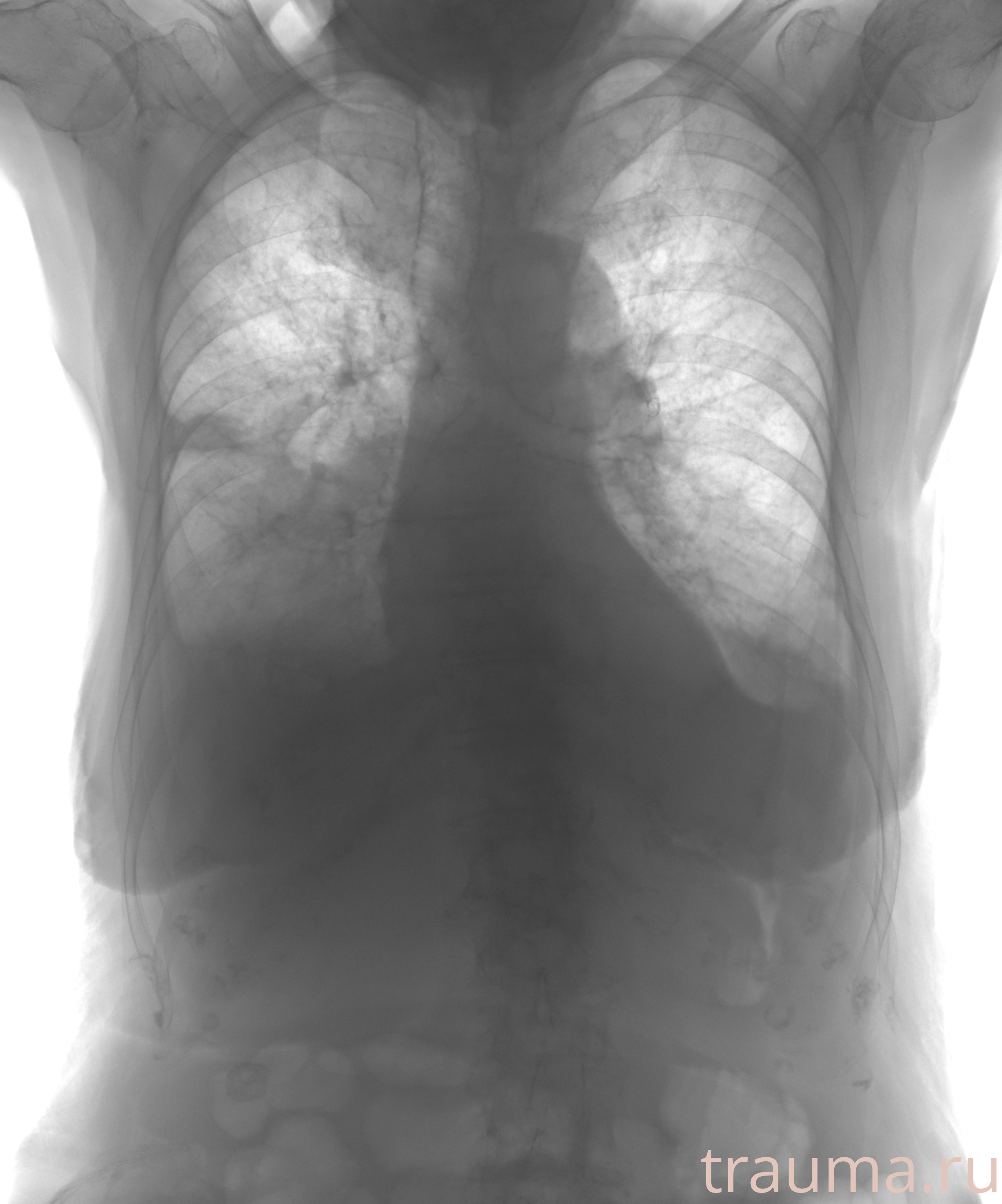 Рентген на дому: по вашему адресу приезжает врач-рентгенолог, травматолог-ортопед с мобильным рентгеновским аппаратом, проводит диагностику травмы или заболевания, делает необходимые рентгенограммы, дает рекомендации по дальнейшему лечению. Получить качественные снимки в домашних условиях возможно благодаря уникальной методике, разработанной МосРентген Центром для института  Склифосовского