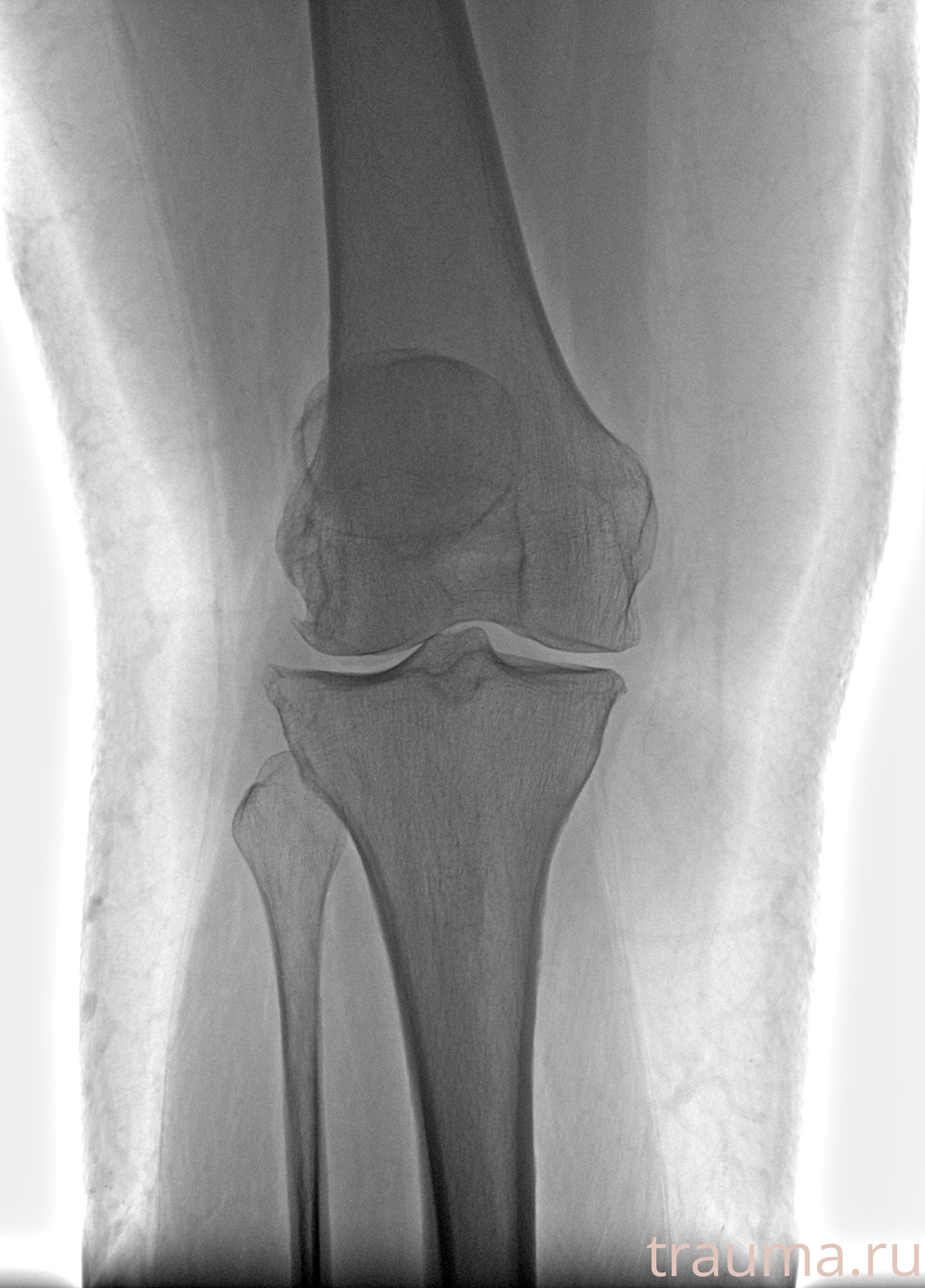 Рентген на дому: по вашему адресу приезжает врач-рентгенолог, травматолог-ортопед с мобильным рентгеновским аппаратом, проводит диагностику травмы или заболевания, делает необходимые рентгенограммы, дает рекомендации по дальнейшему лечению. Получить качественные снимки в домашних условиях возможно благодаря уникальной методике, разработанной МосРентген Центром для института  Склифосовского