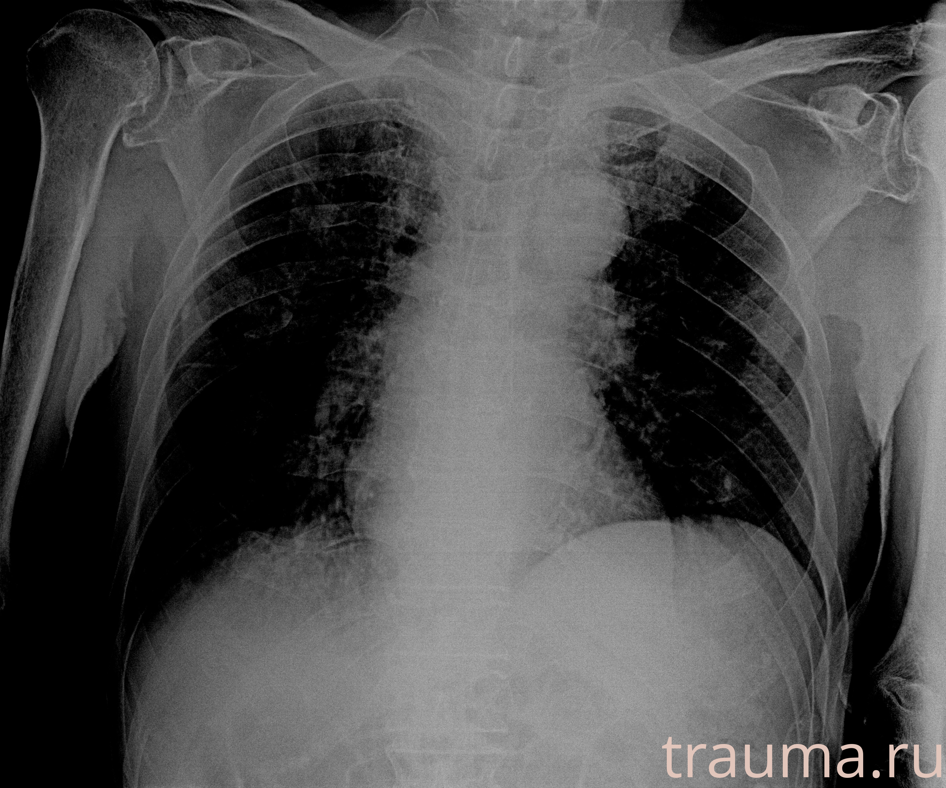 Рентген на дому: по вашему адресу приезжает врач-рентгенолог, травматолог-ортопед с мобильным рентгеновским аппаратом, проводит диагностику травмы или заболевания, делает необходимые рентгенограммы, дает рекомендации по дальнейшему лечению. Получить качественные снимки в домашних условиях возможно благодаря уникальной методике, разработанной МосРентген Центром для института  Склифосовского