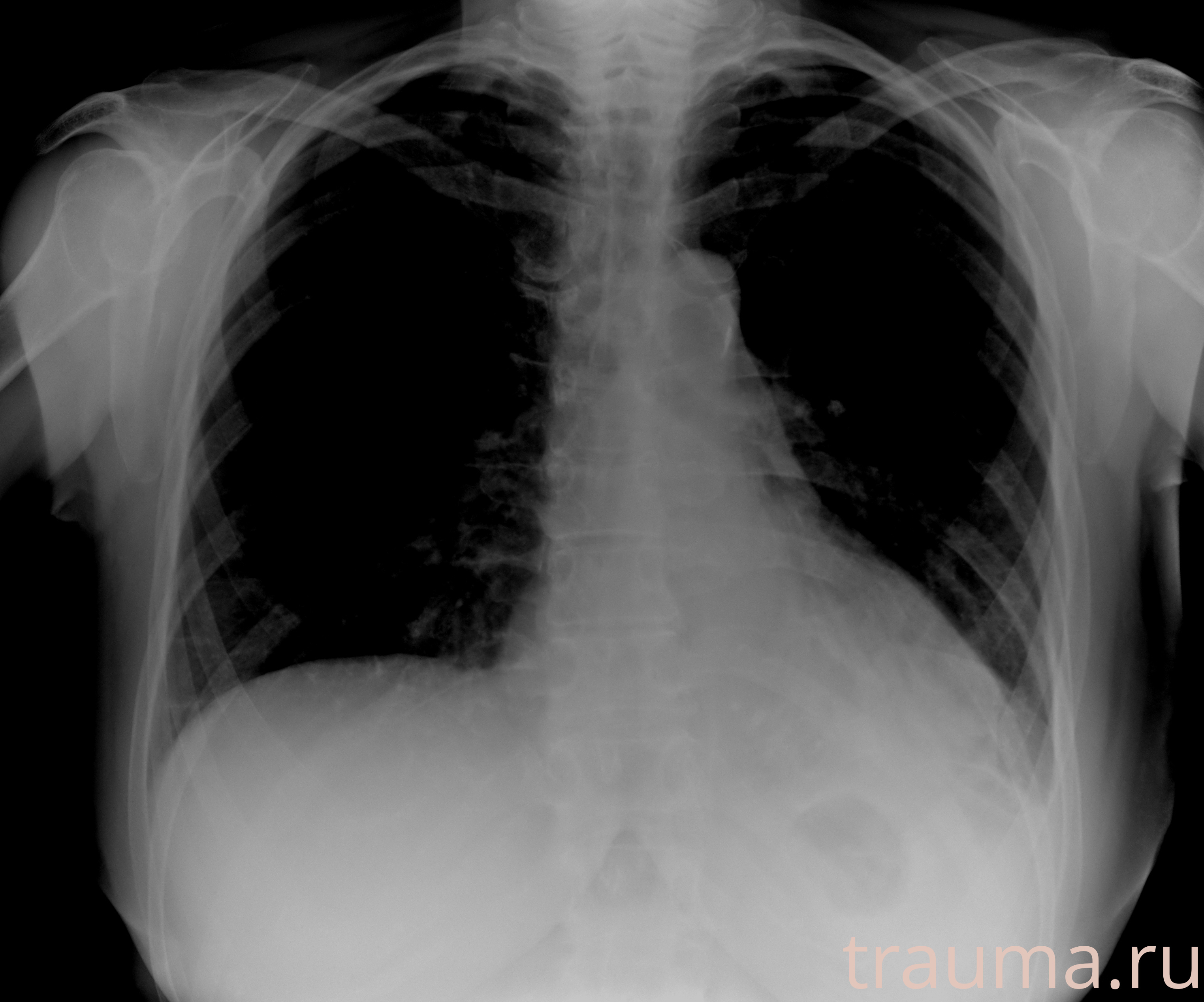 Рентген на дому: по вашему адресу приезжает врач-рентгенолог, травматолог-ортопед с мобильным рентгеновским аппаратом, проводит диагностику травмы или заболевания, делает необходимые рентгенограммы, дает рекомендации по дальнейшему лечению. Получить качественные снимки в домашних условиях возможно благодаря уникальной методике, разработанной МосРентген Центром для института  Склифосовского