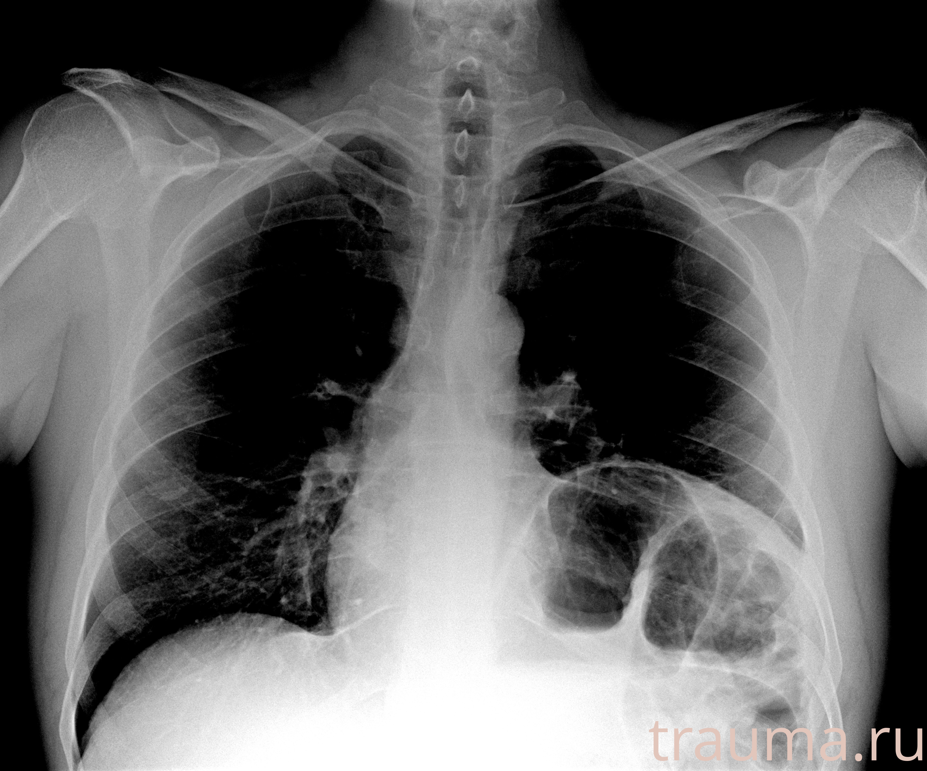 Рентген на дому: по вашему адресу приезжает врач-рентгенолог, травматолог-ортопед с мобильным рентгеновским аппаратом, проводит диагностику травмы или заболевания, делает необходимые рентгенограммы, дает рекомендации по дальнейшему лечению. Получить качественные снимки в домашних условиях возможно благодаря уникальной методике, разработанной МосРентген Центром для института  Склифосовского