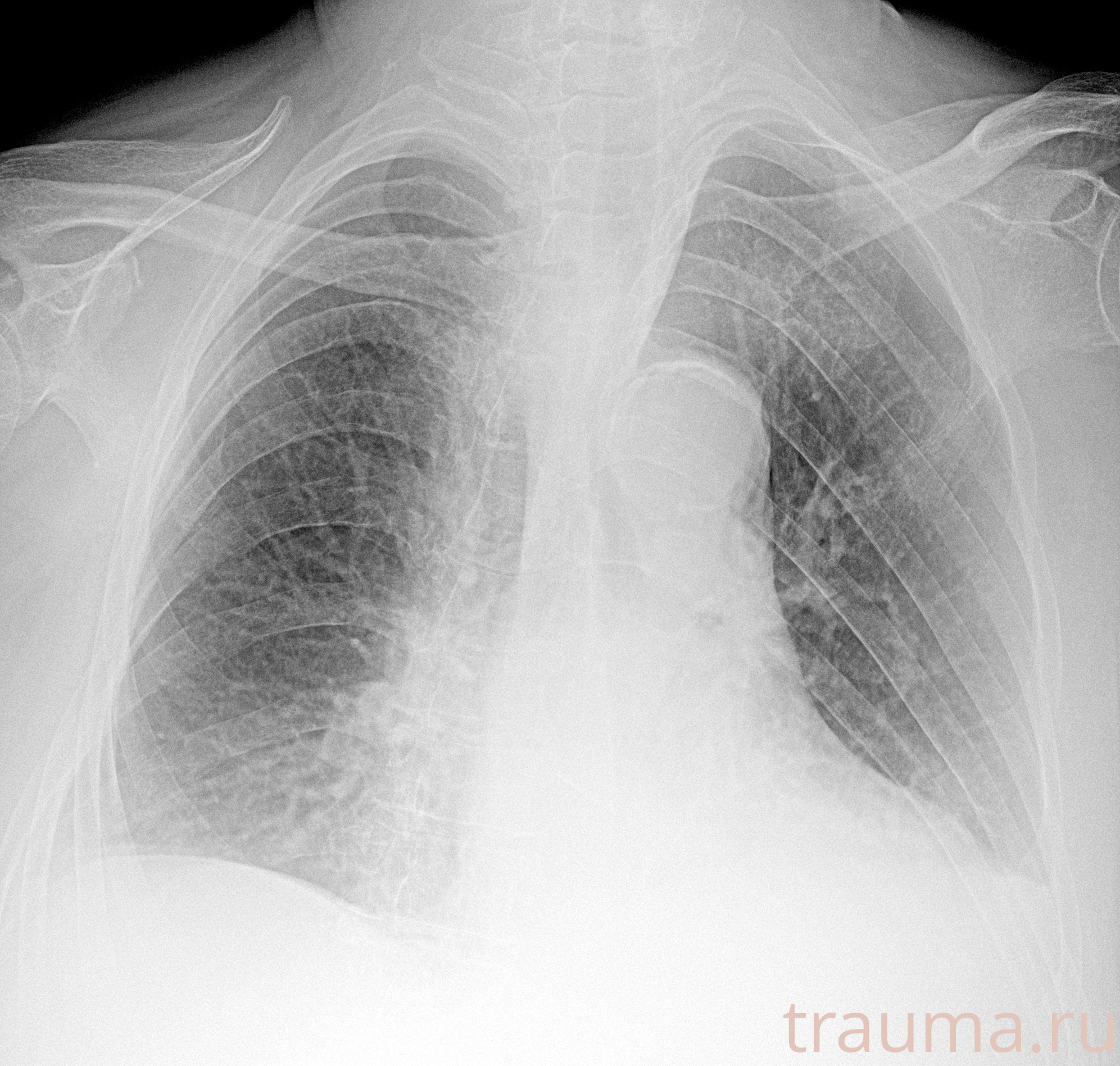 Рентген на дому: по вашему адресу приезжает врач-рентгенолог, травматолог-ортопед с мобильным рентгеновским аппаратом, проводит диагностику травмы или заболевания, делает необходимые рентгенограммы, дает рекомендации по дальнейшему лечению. Получить качественные снимки в домашних условиях возможно благодаря уникальной методике, разработанной МосРентген Центром для института  Склифосовского