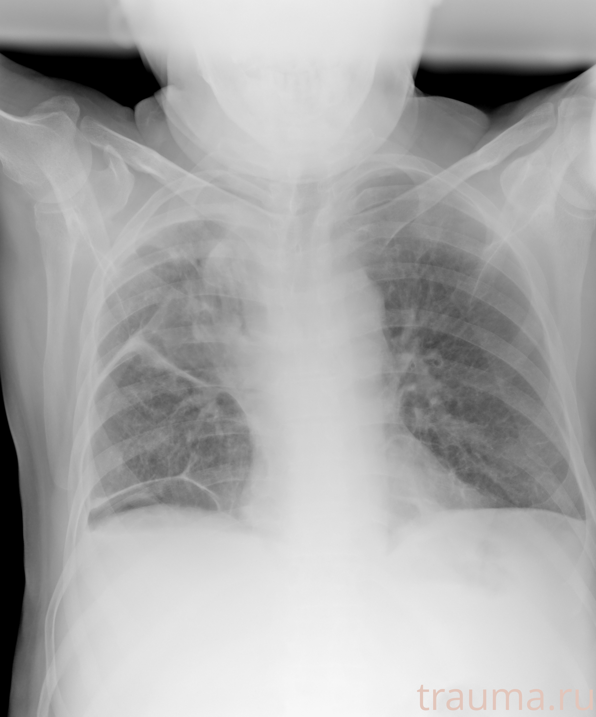 Рентген на дому: по вашему адресу приезжает врач-рентгенолог, травматолог-ортопед с мобильным рентгеновским аппаратом, проводит диагностику травмы или заболевания, делает необходимые рентгенограммы, дает рекомендации по дальнейшему лечению. Получить качественные снимки в домашних условиях возможно благодаря уникальной методике, разработанной МосРентген Центром для института  Склифосовского