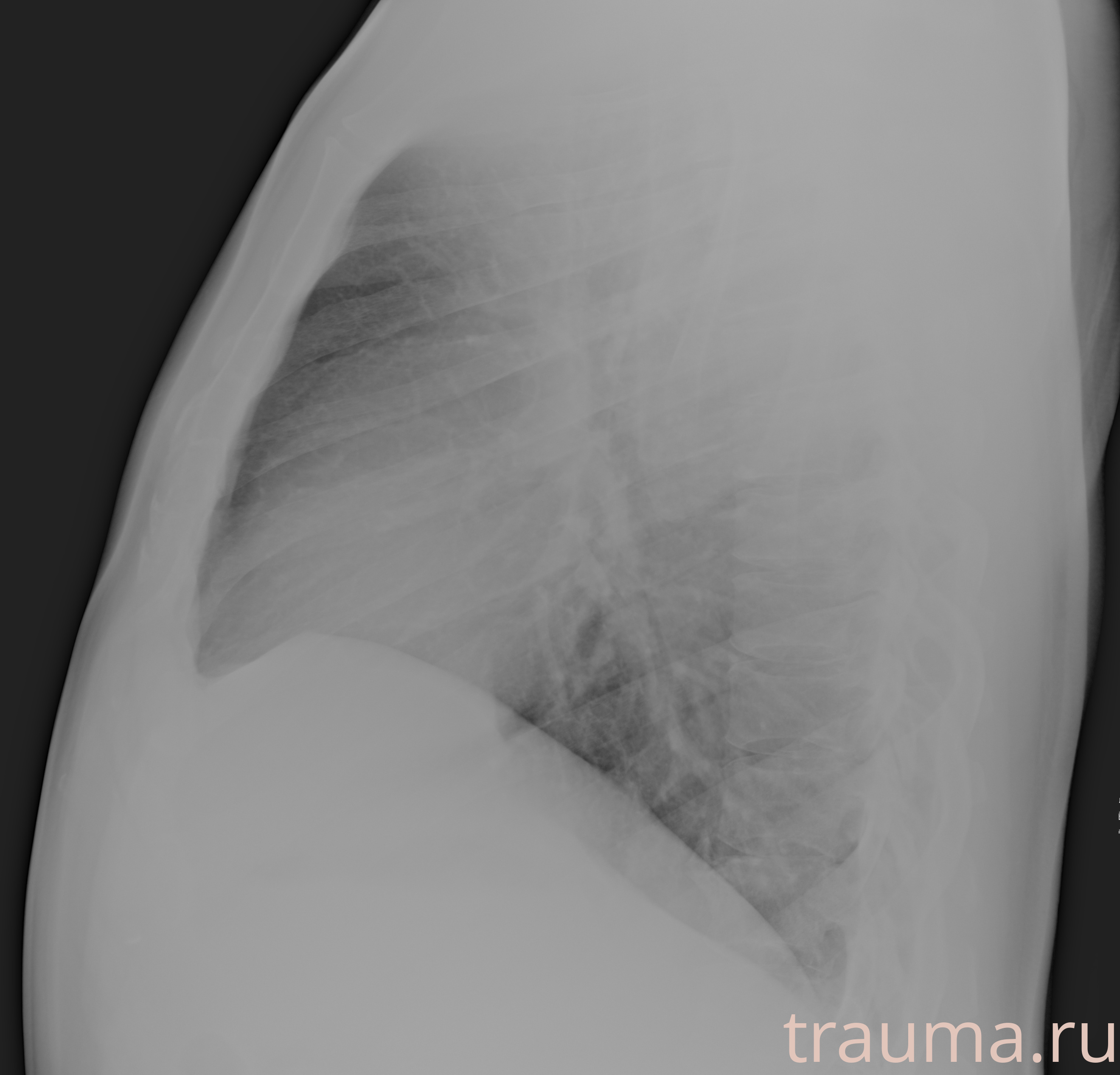 Рентген на дому: по вашему адресу приезжает врач-рентгенолог, травматолог-ортопед с мобильным рентгеновским аппаратом, проводит диагностику травмы или заболевания, делает необходимые рентгенограммы, дает рекомендации по дальнейшему лечению. Получить качественные снимки в домашних условиях возможно благодаря уникальной методике, разработанной МосРентген Центром для института  Склифосовского