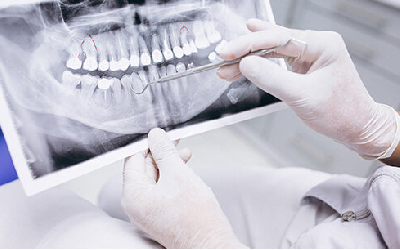 Минздрав намерен запретить стоматологиям использовать рентген в жилых домах 