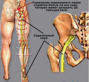 Оценка эффективности субпараневральной блокады седалищного нерва у пациентов после реконсруктивно-корригирующих операций на  стопе