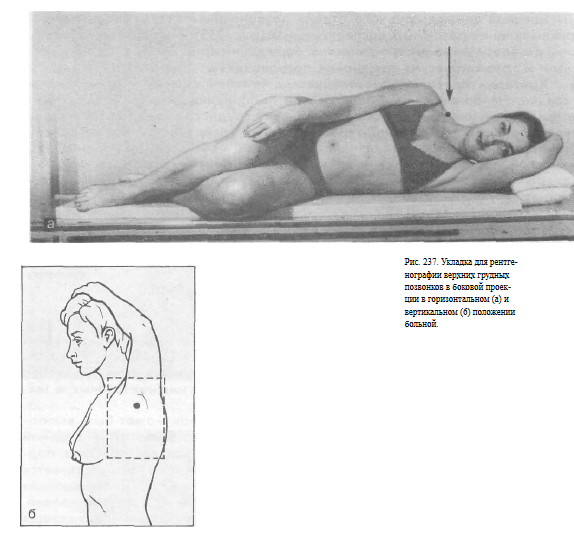 Снимки грудного отдела позвоночника укладка thumbnail