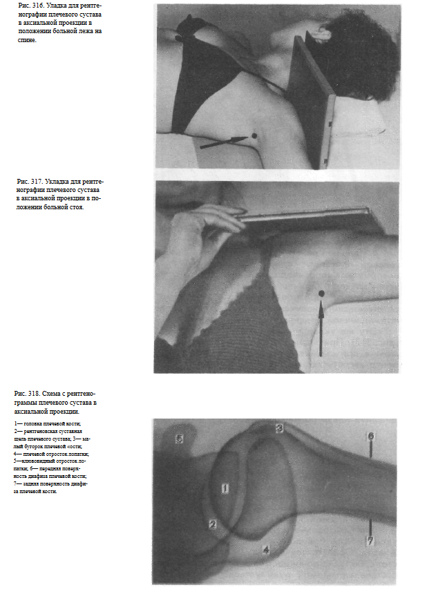 Плечевой сустав в разных проекциях