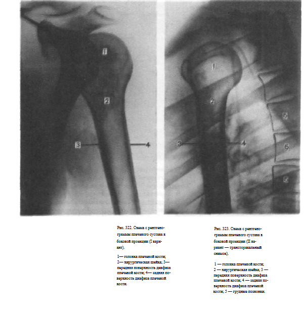 Плечевой сустав в разных проекциях
