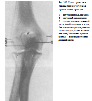 Локтевой сустав рентген укладки thumbnail