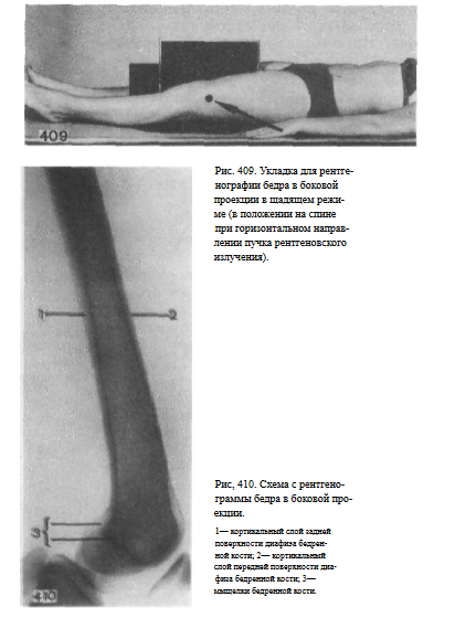 Снимок коленного сустава в прямой проекции