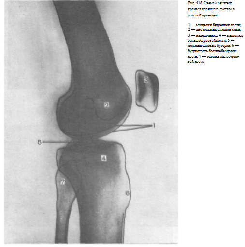 Снимок коленного сустава в прямой проекции