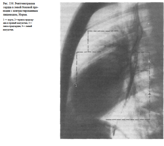 Проекция сердца на позвоночник