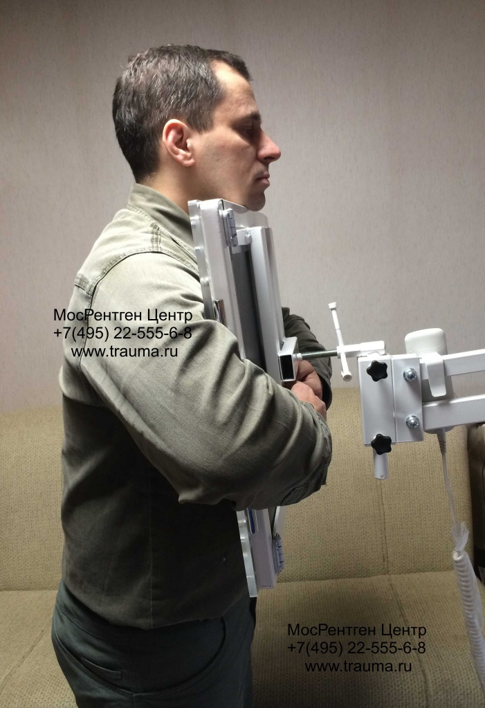 Грудная стойка МосРентген Центр предназначена для выполнения рентгеновских снимков в вертикальном положении, в основном для рентгена легких. Может оснащаться растром.