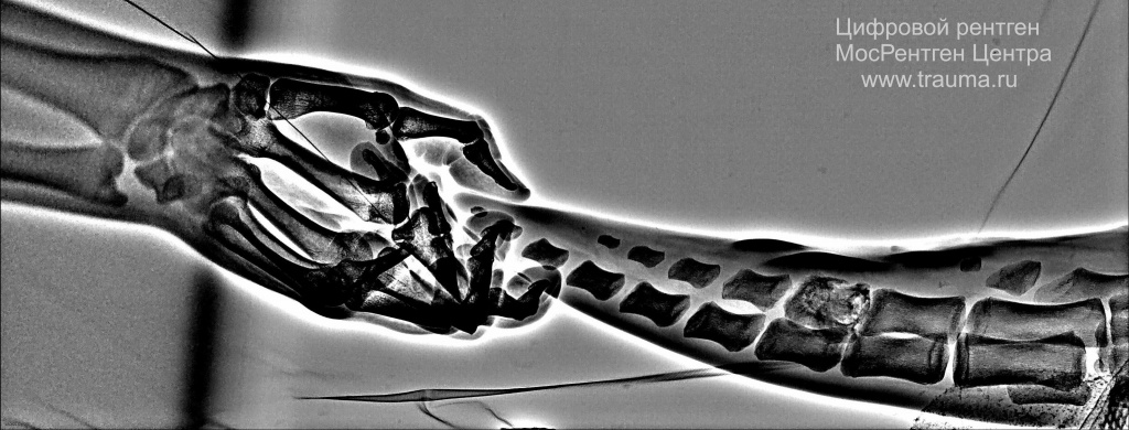 Рентген дельфина