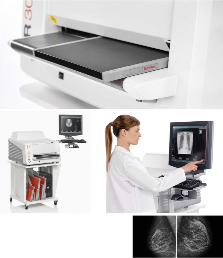 Рентгеновский оцифровщик для маммографии AGFA CR 30-Xm