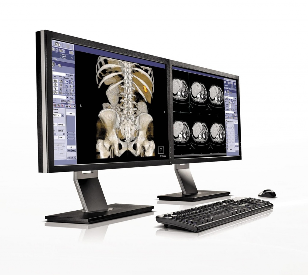 ОФЭКТ/КТ - однофотонная эмиссионная компьютерная томография, совмещенная с компьютерной томографией